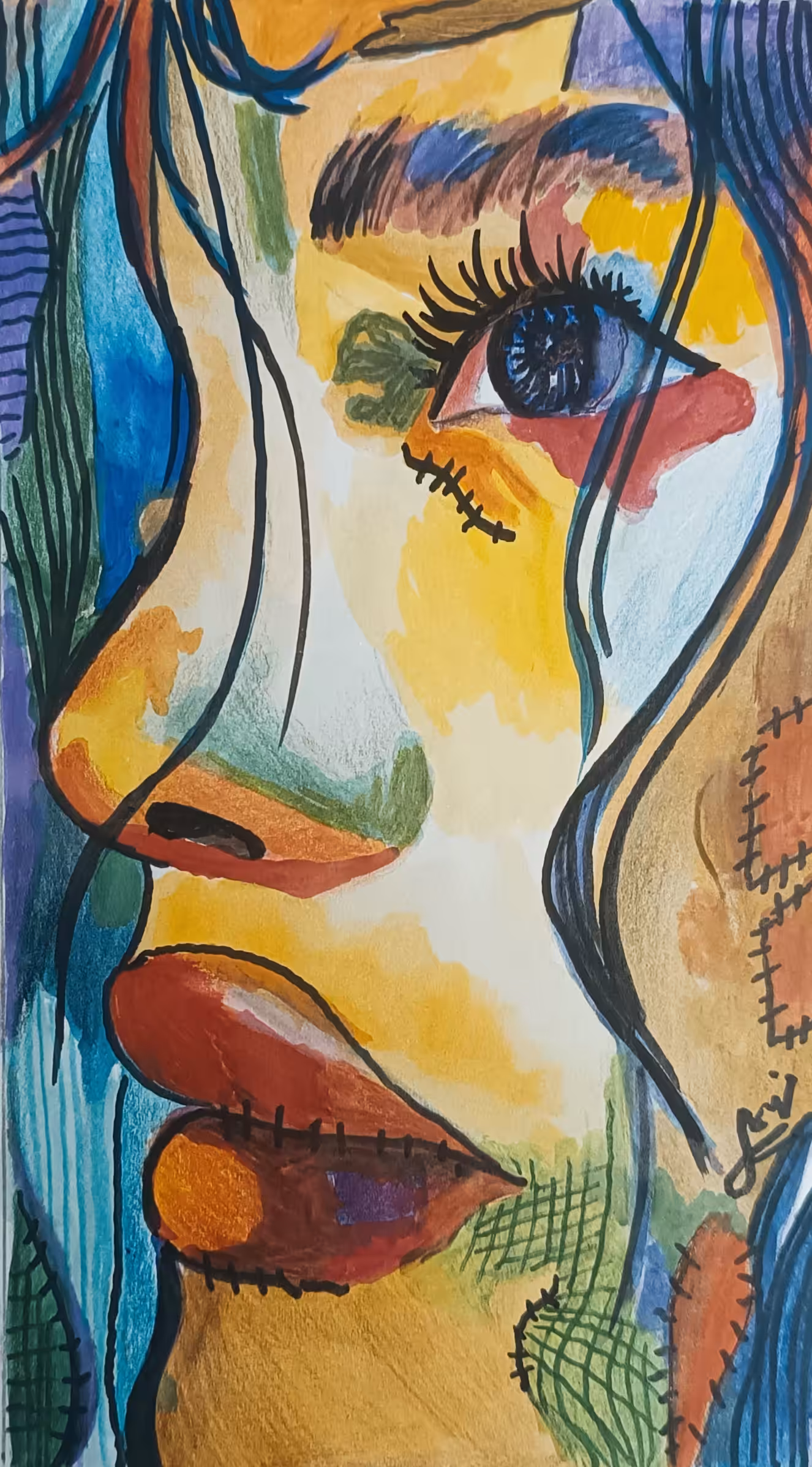 Wounded