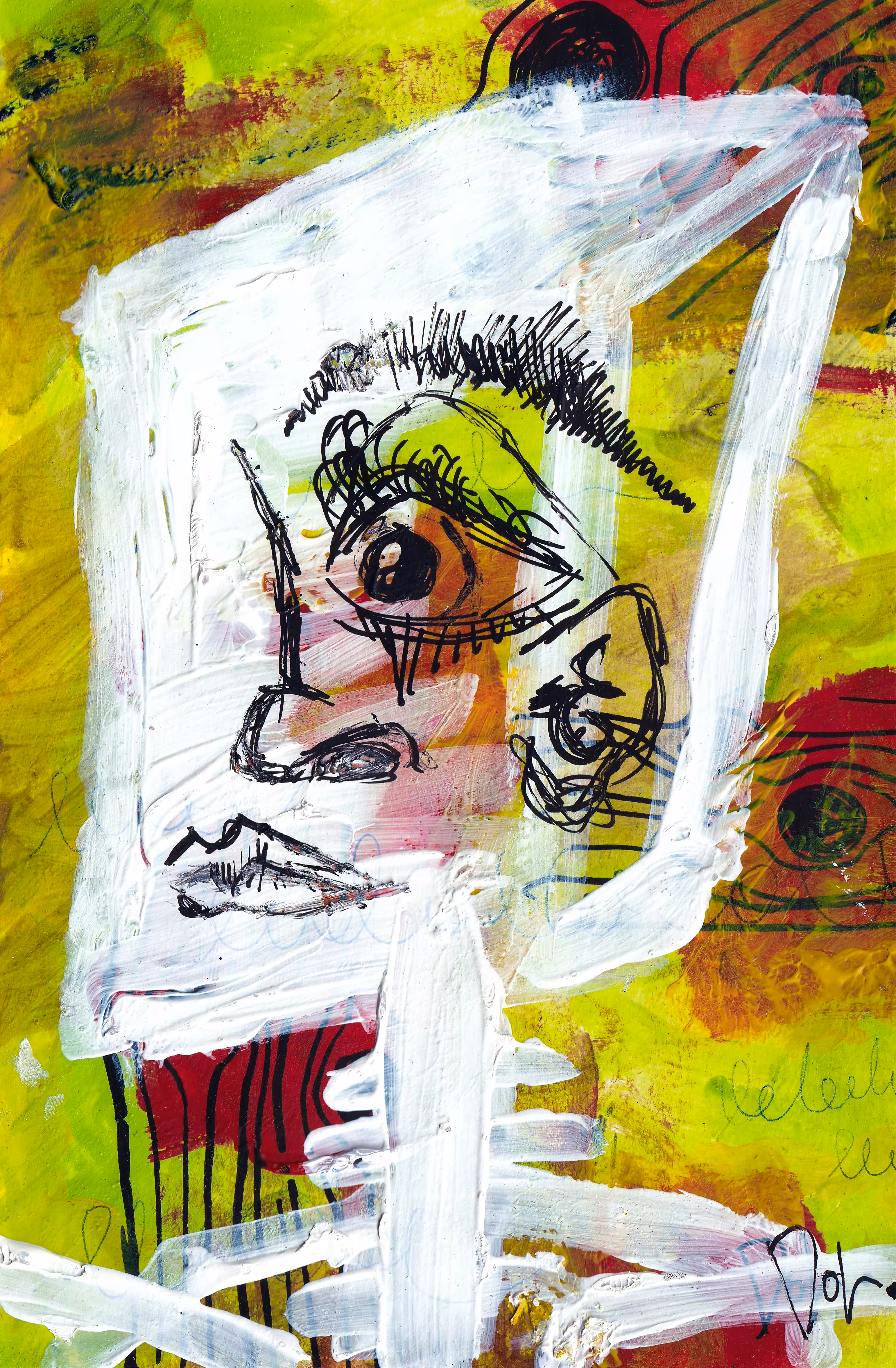 Headache V