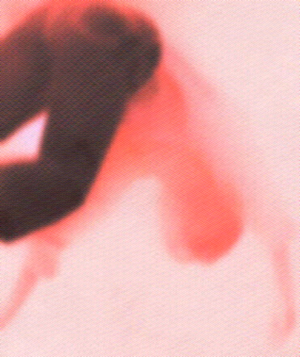 IN FILLINGS (0-00-00-00)