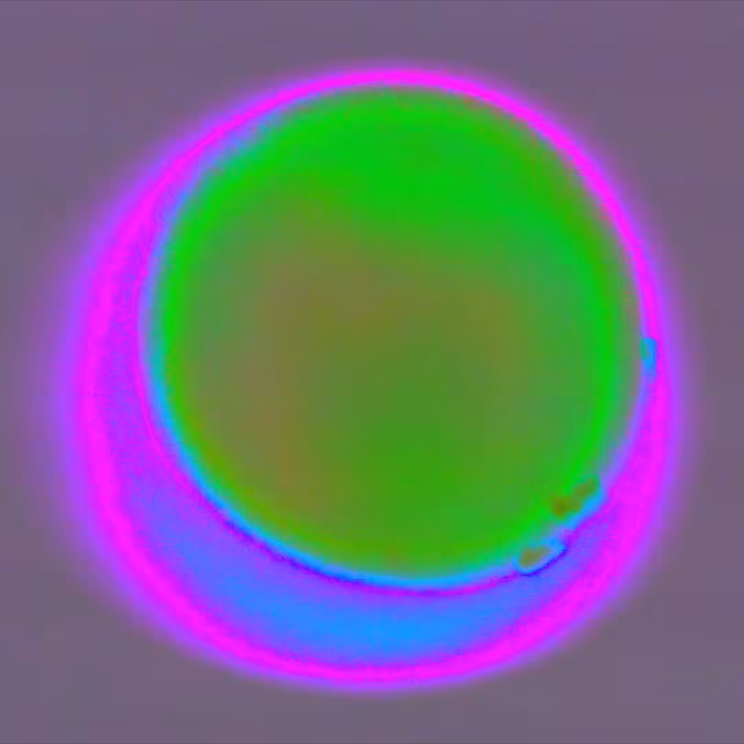 Orb Green Pink ORBS4BRG