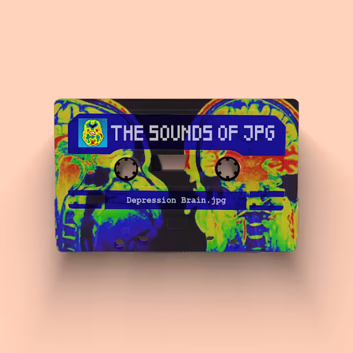Sounds Of Depression Brain