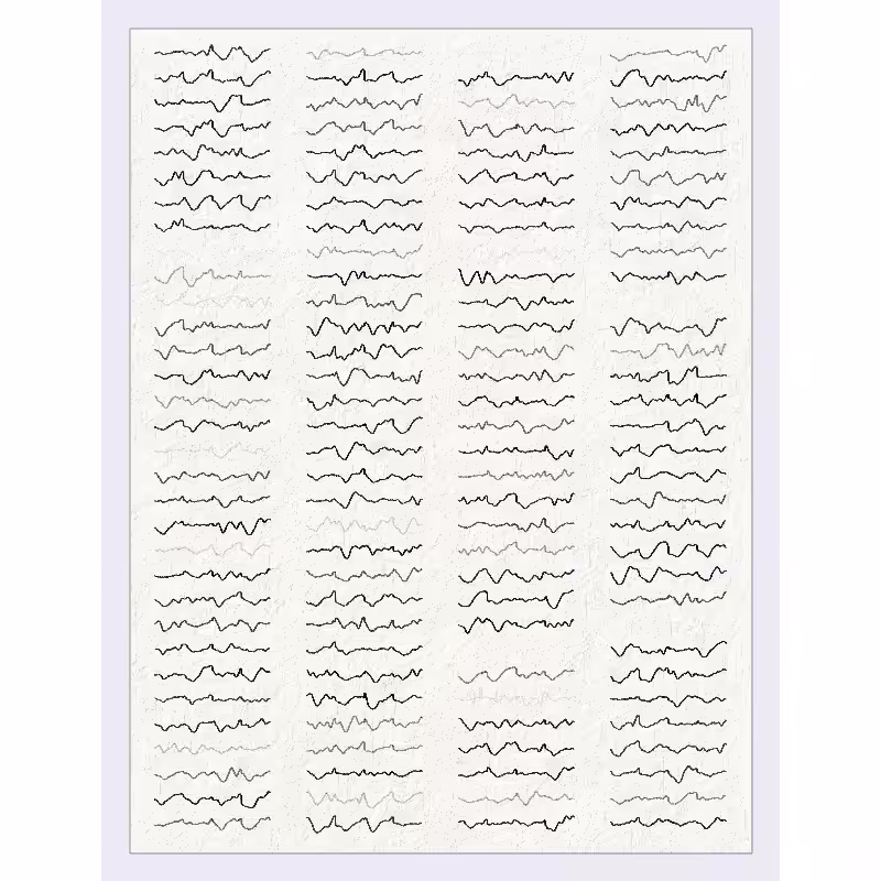 Waveforms #3