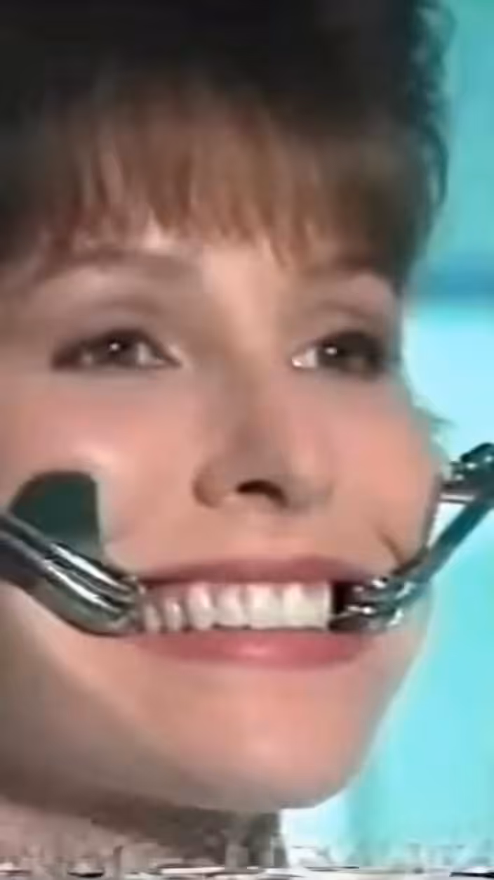 PERMA SONRISA