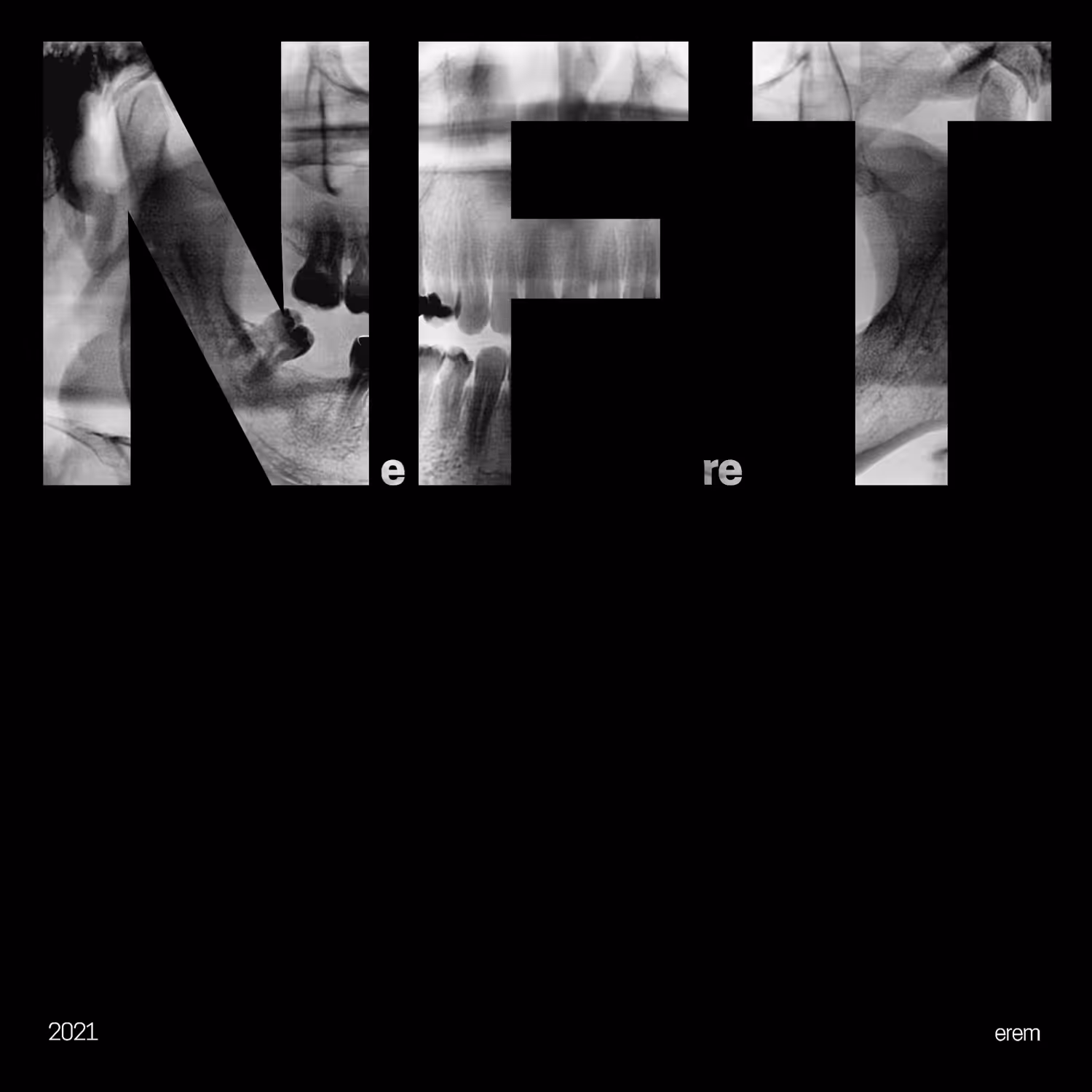 NeFreT