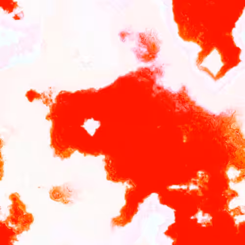 Infinite #362