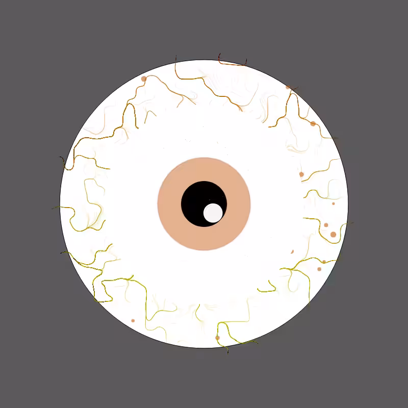 Eyeball after final Exam #1