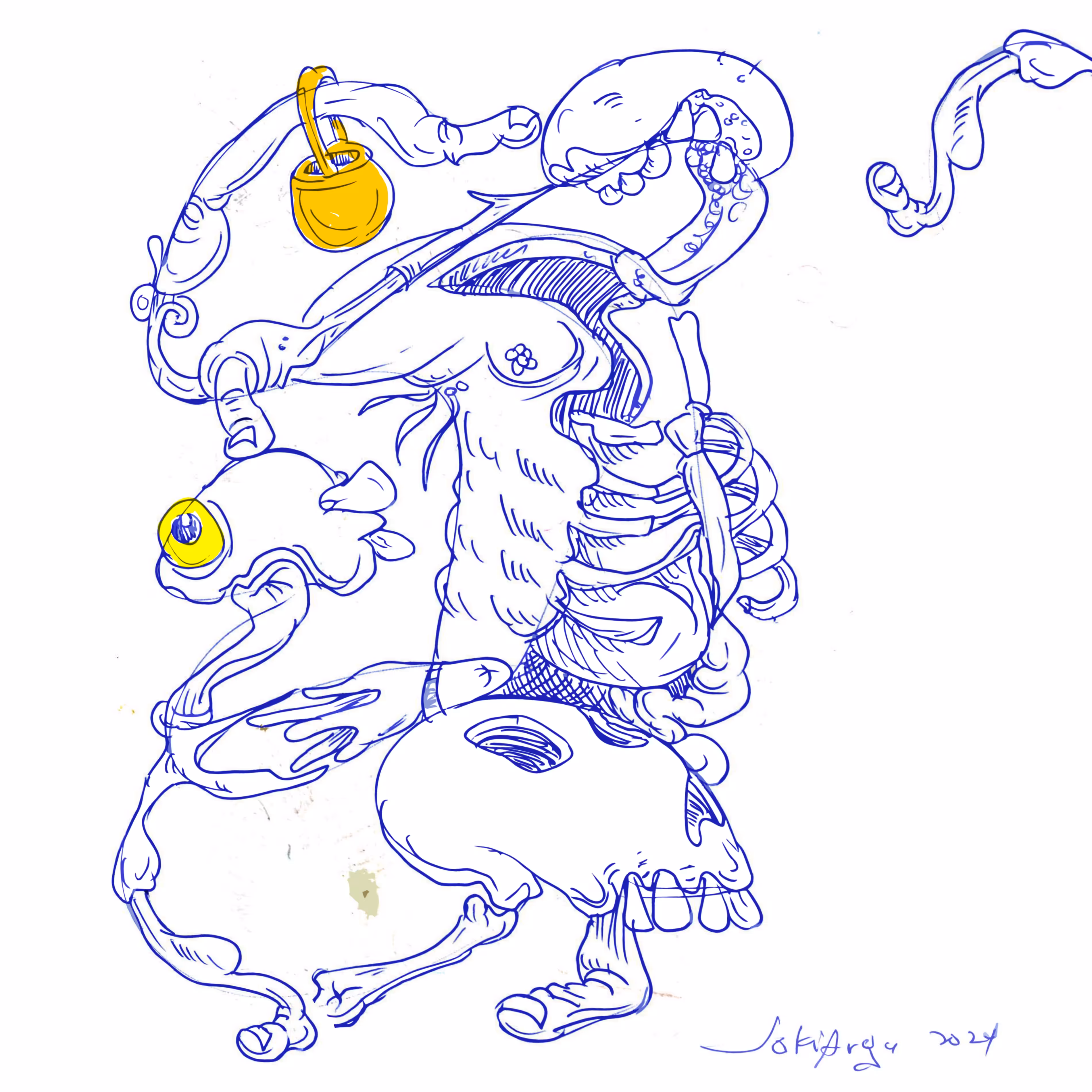 jaundice