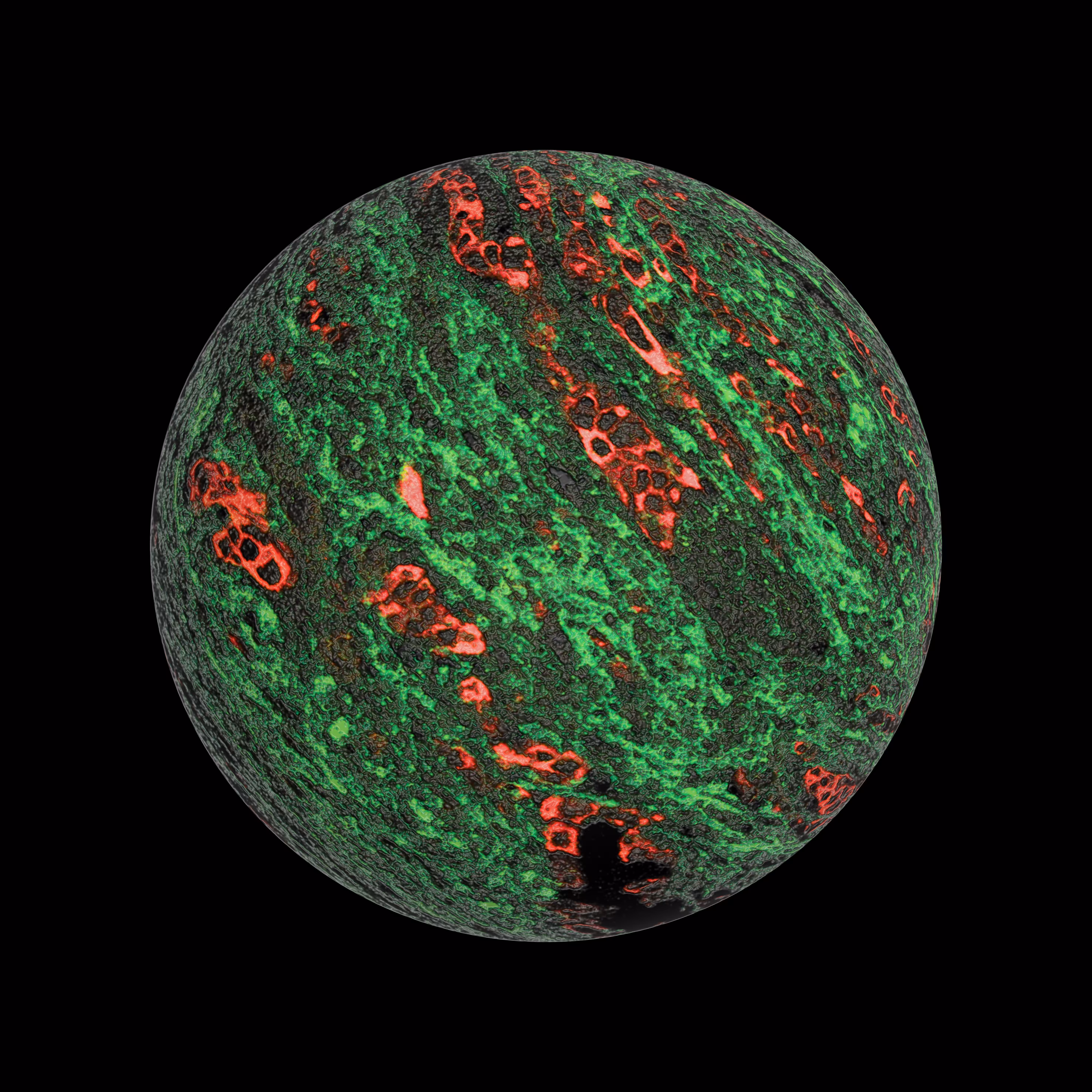 Glioma