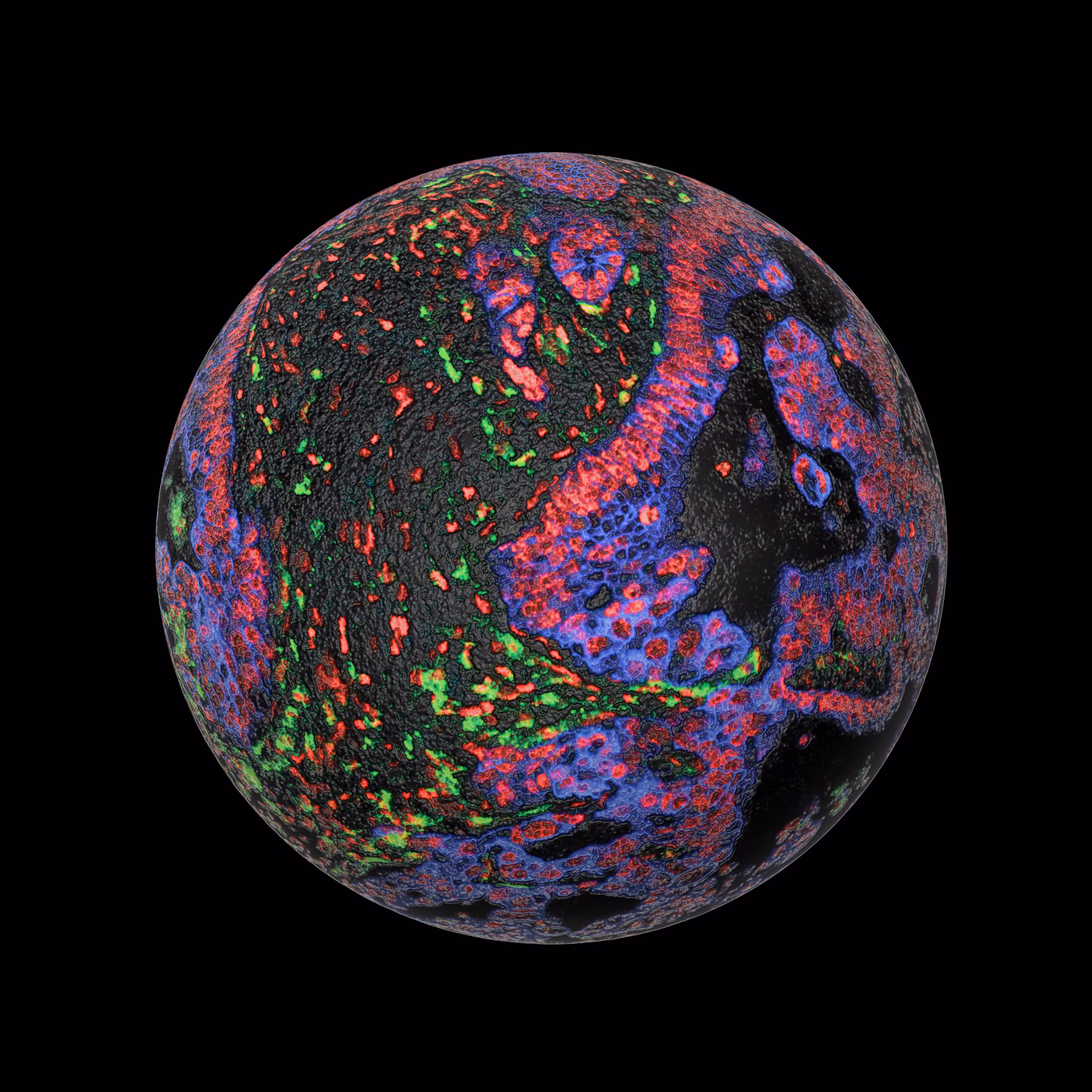 Neuroblastoma