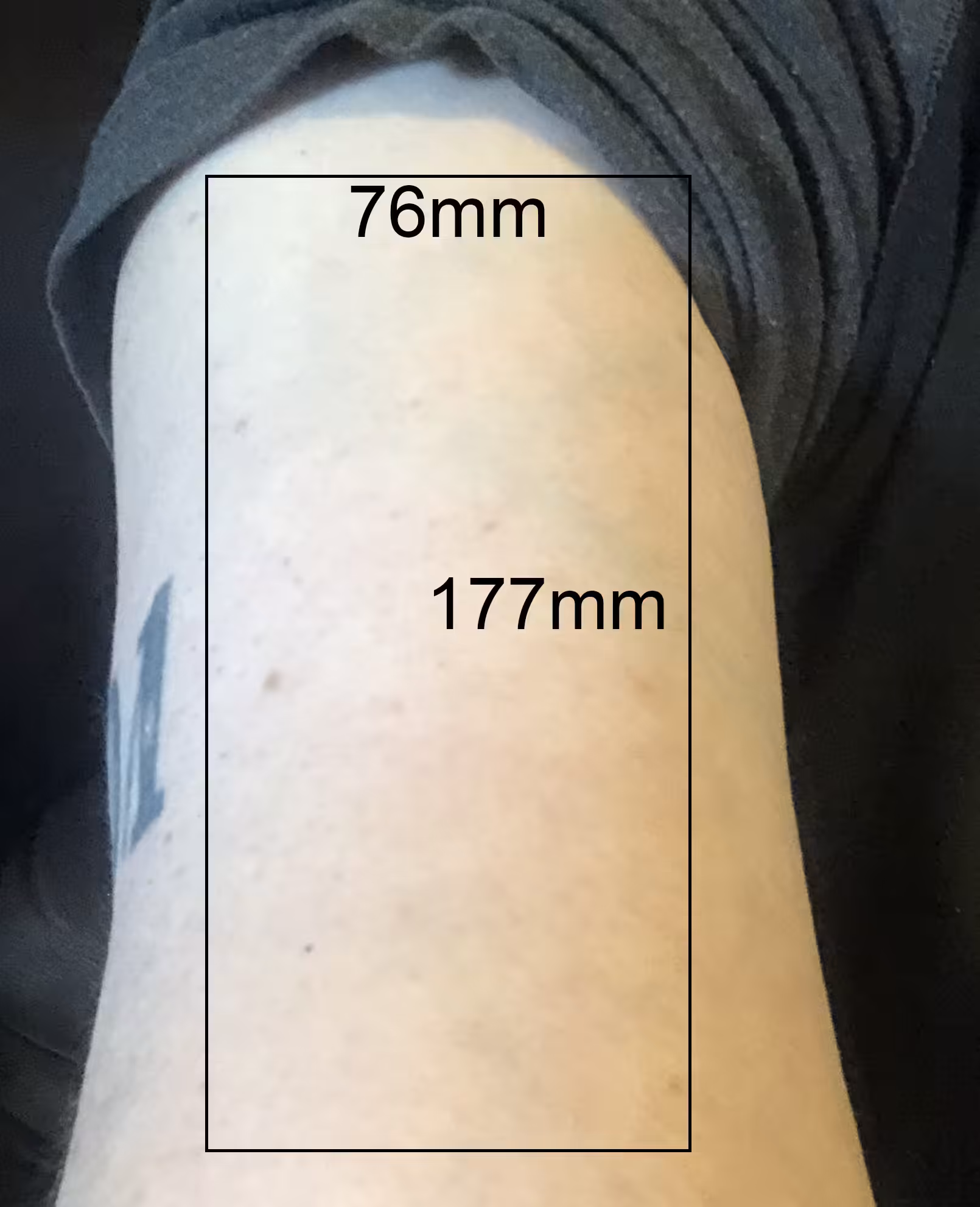 Lot #17 [76mm x 177mm Right Bicep Top]