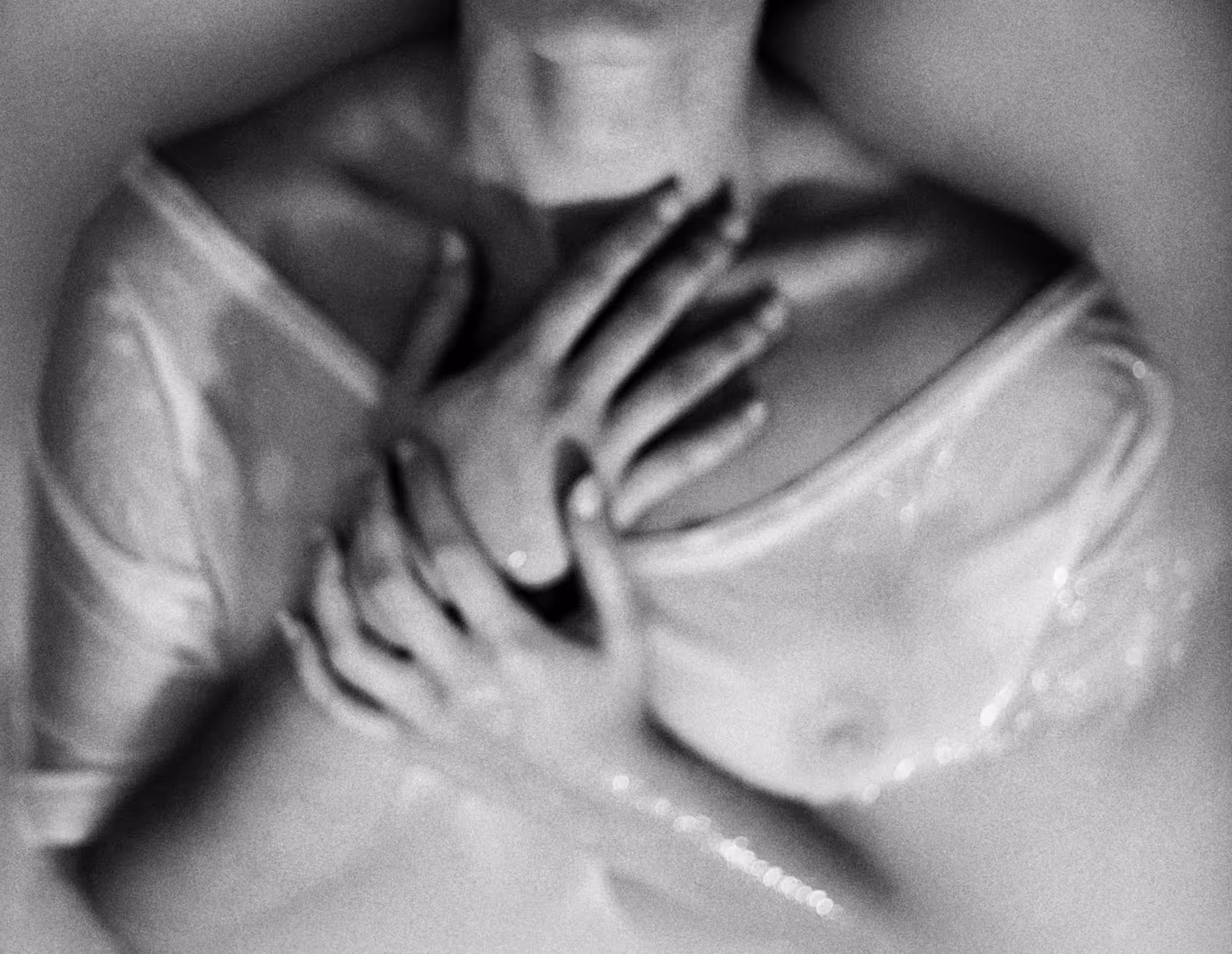 asphyxia