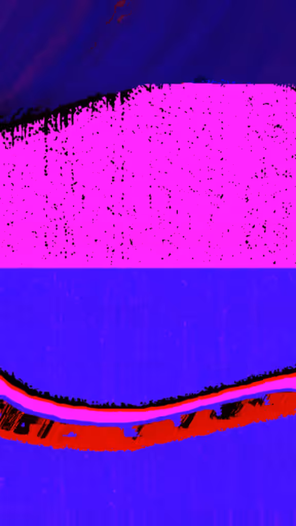 corruption²⁰