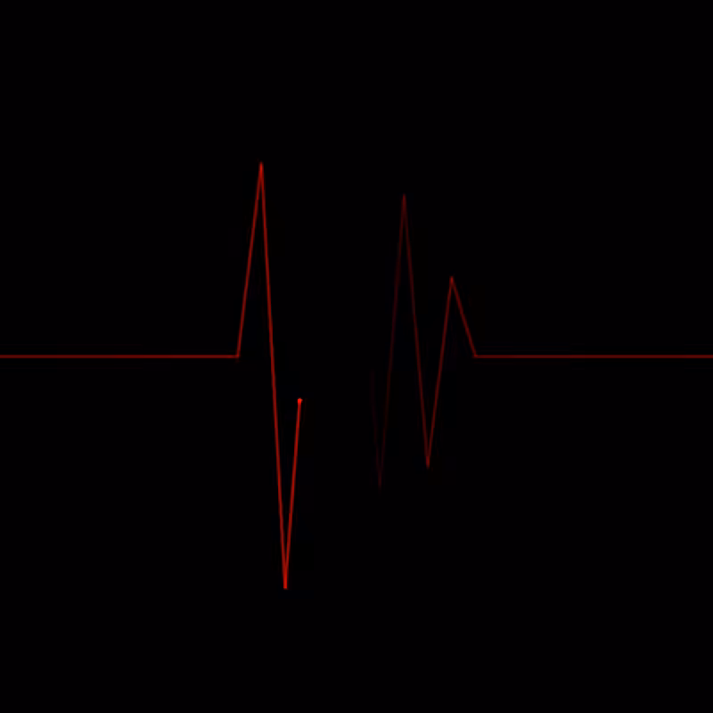 Beat of heart #3