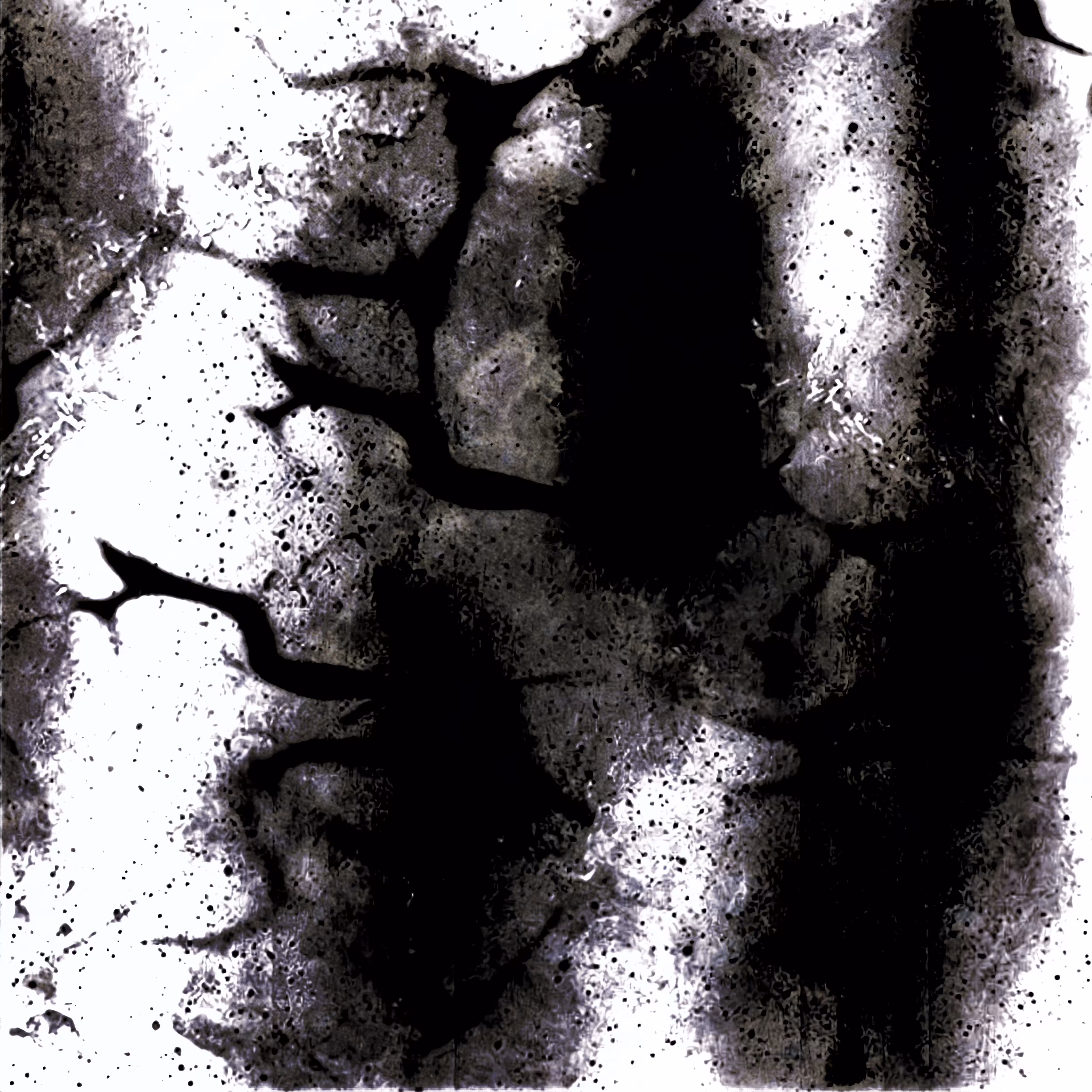 BrainDead #01