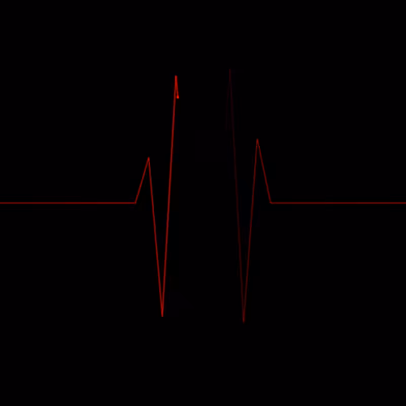 Beat of heart #2