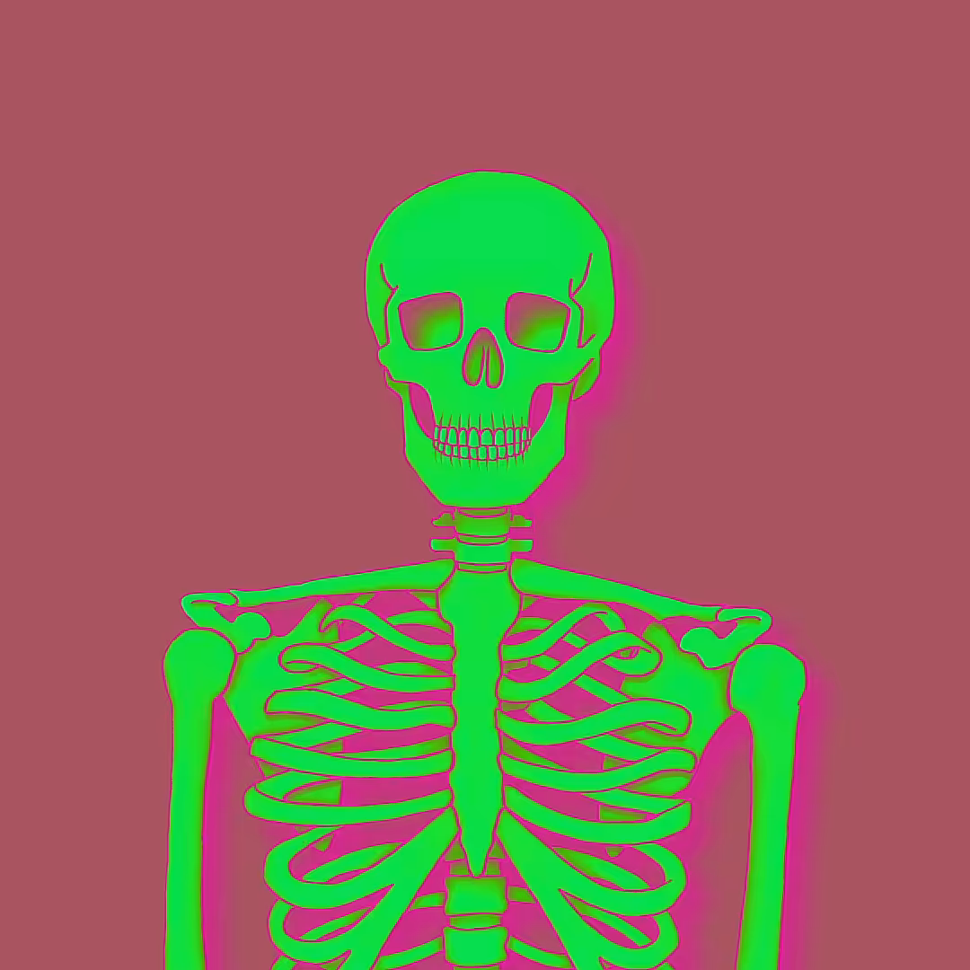 Skele-Links: SKELE-LINK #106