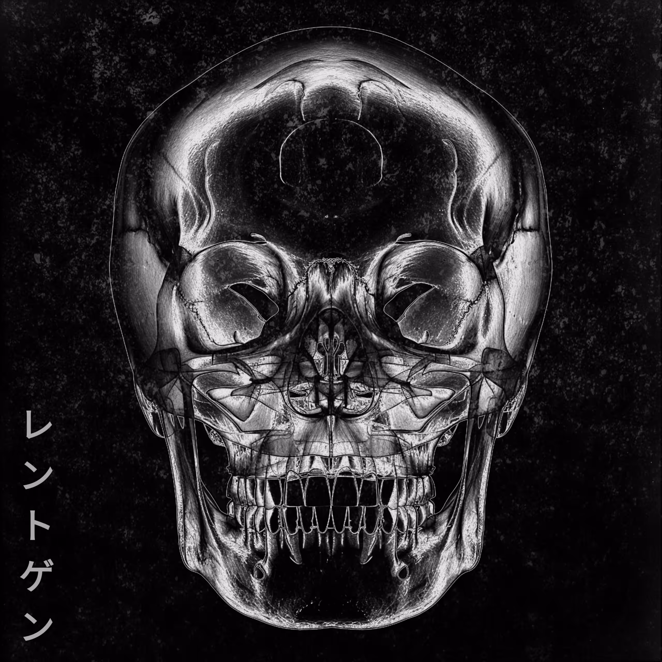 X-traordinary (ントゲン)