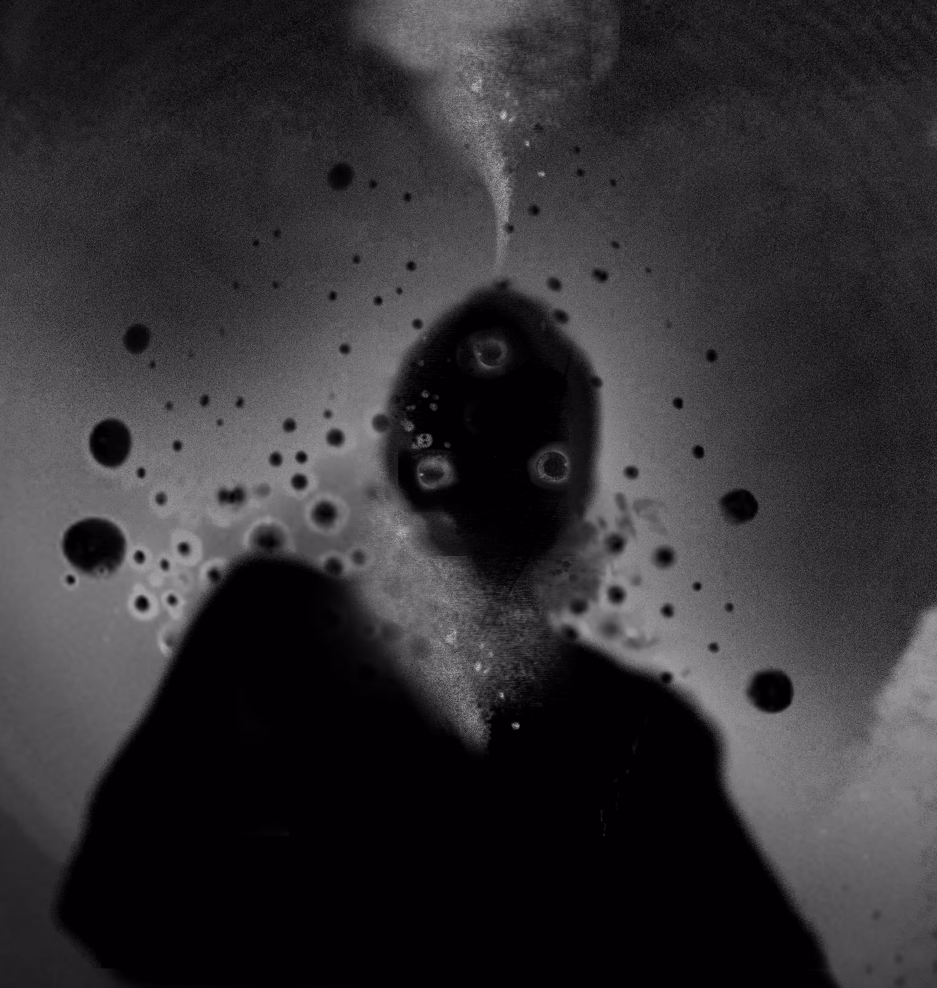 Infection