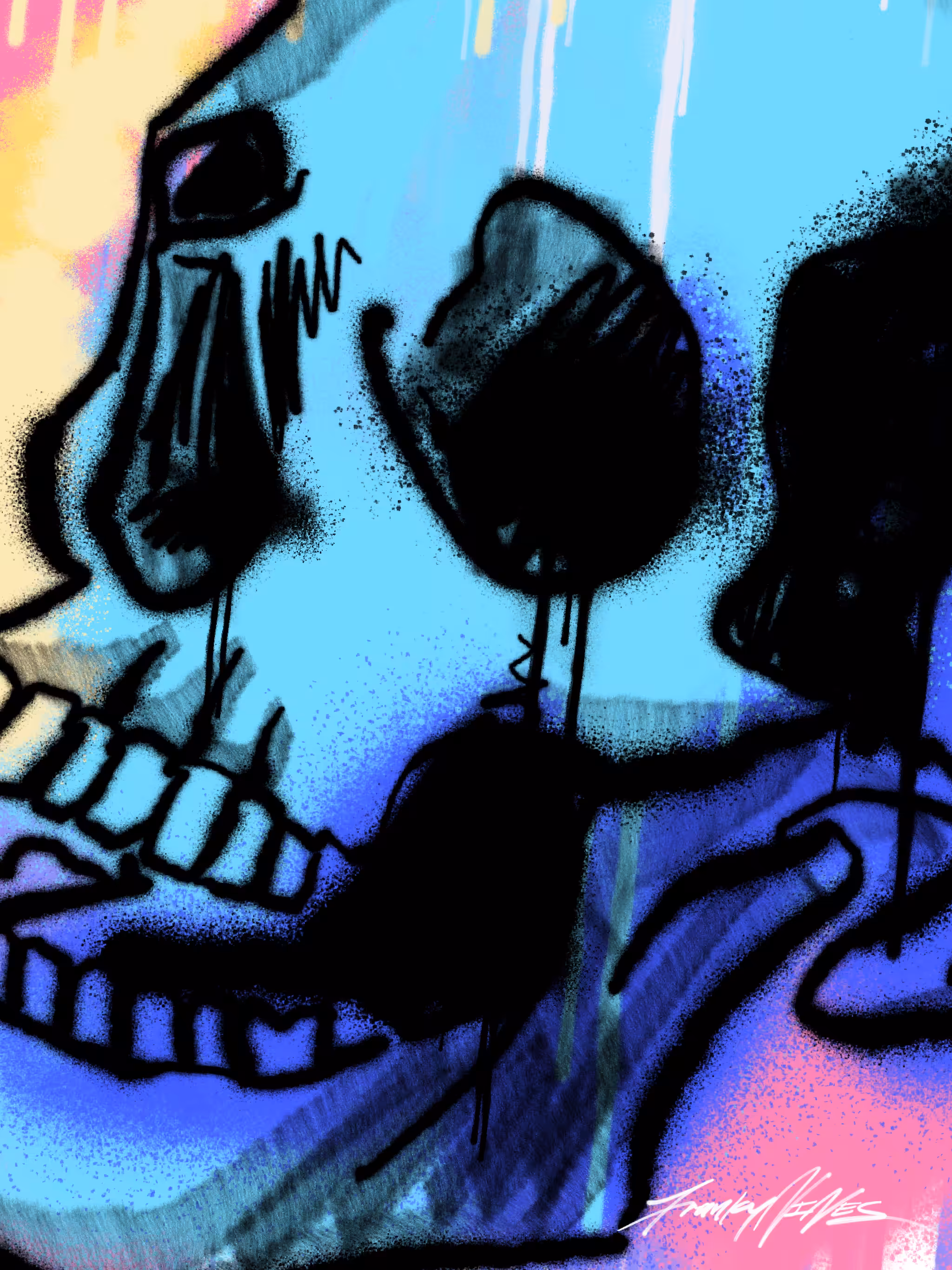 Skulliosis