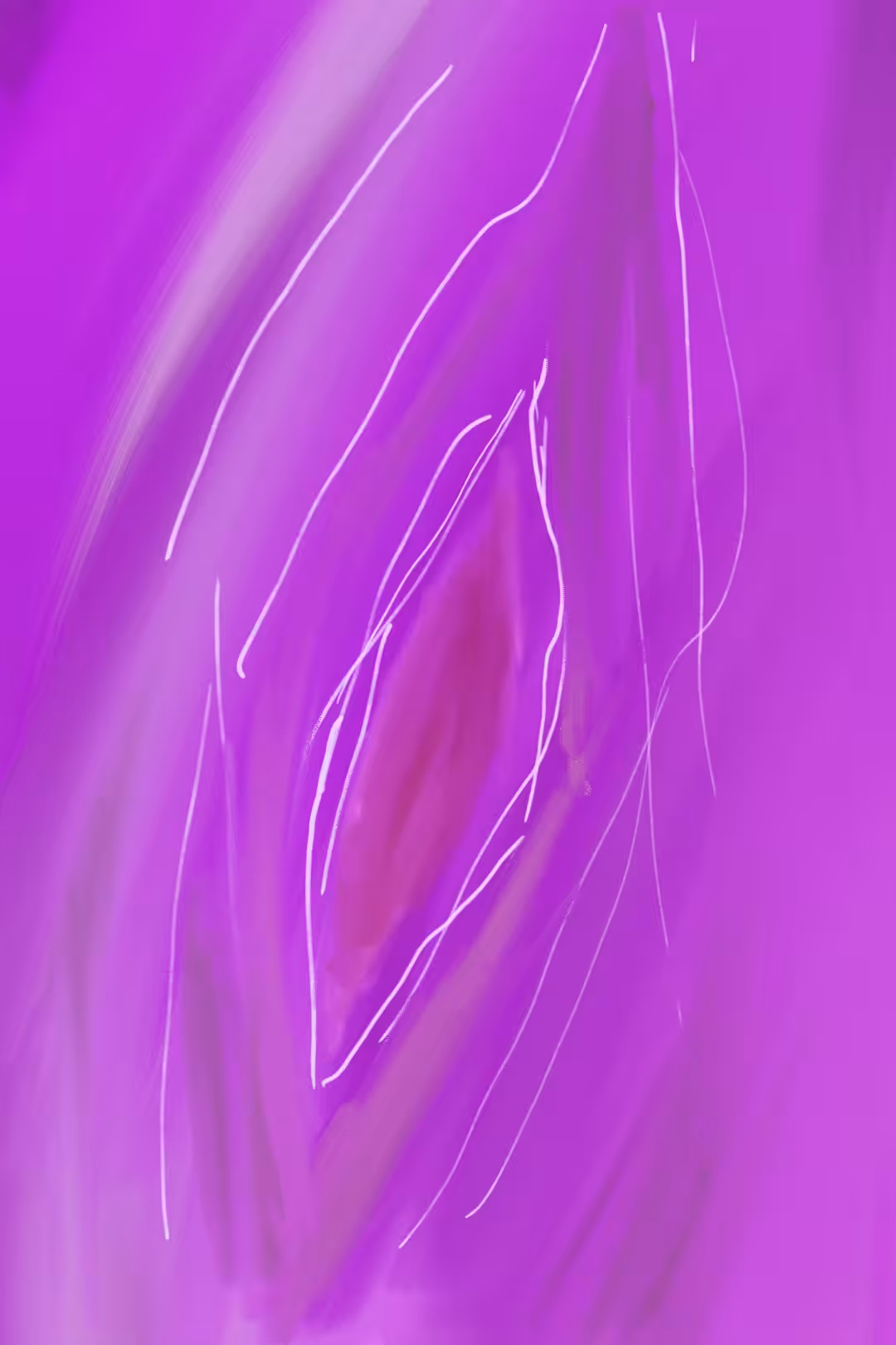 The Slit