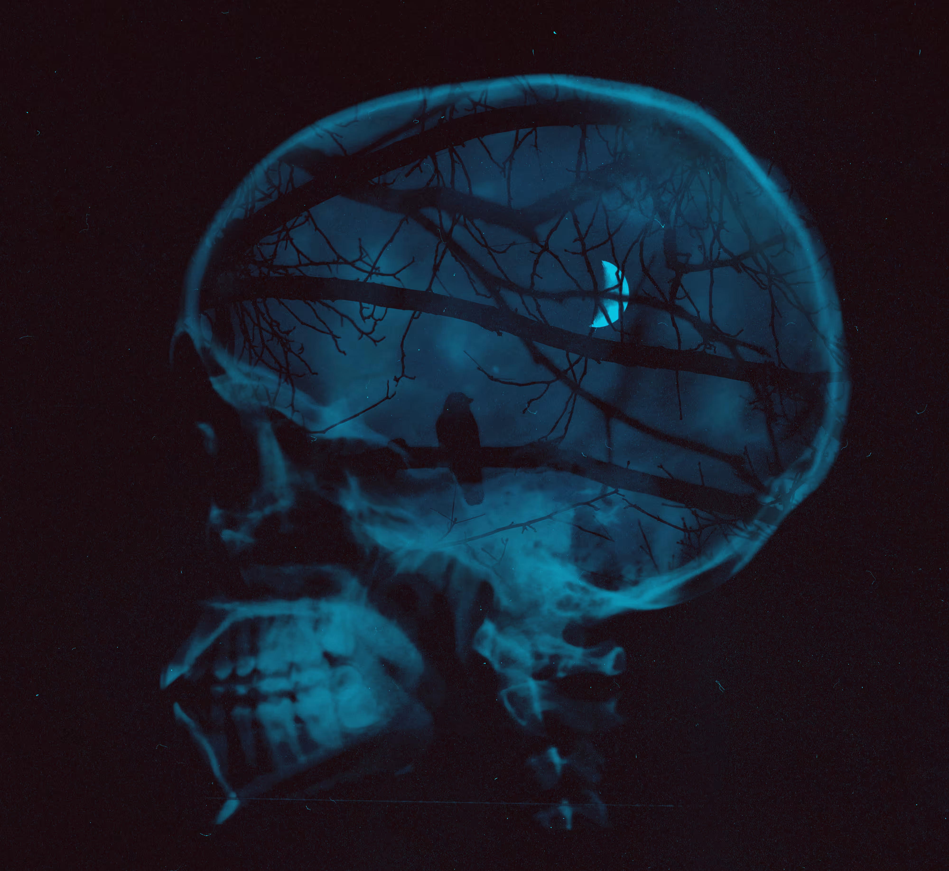 Inside my skull...