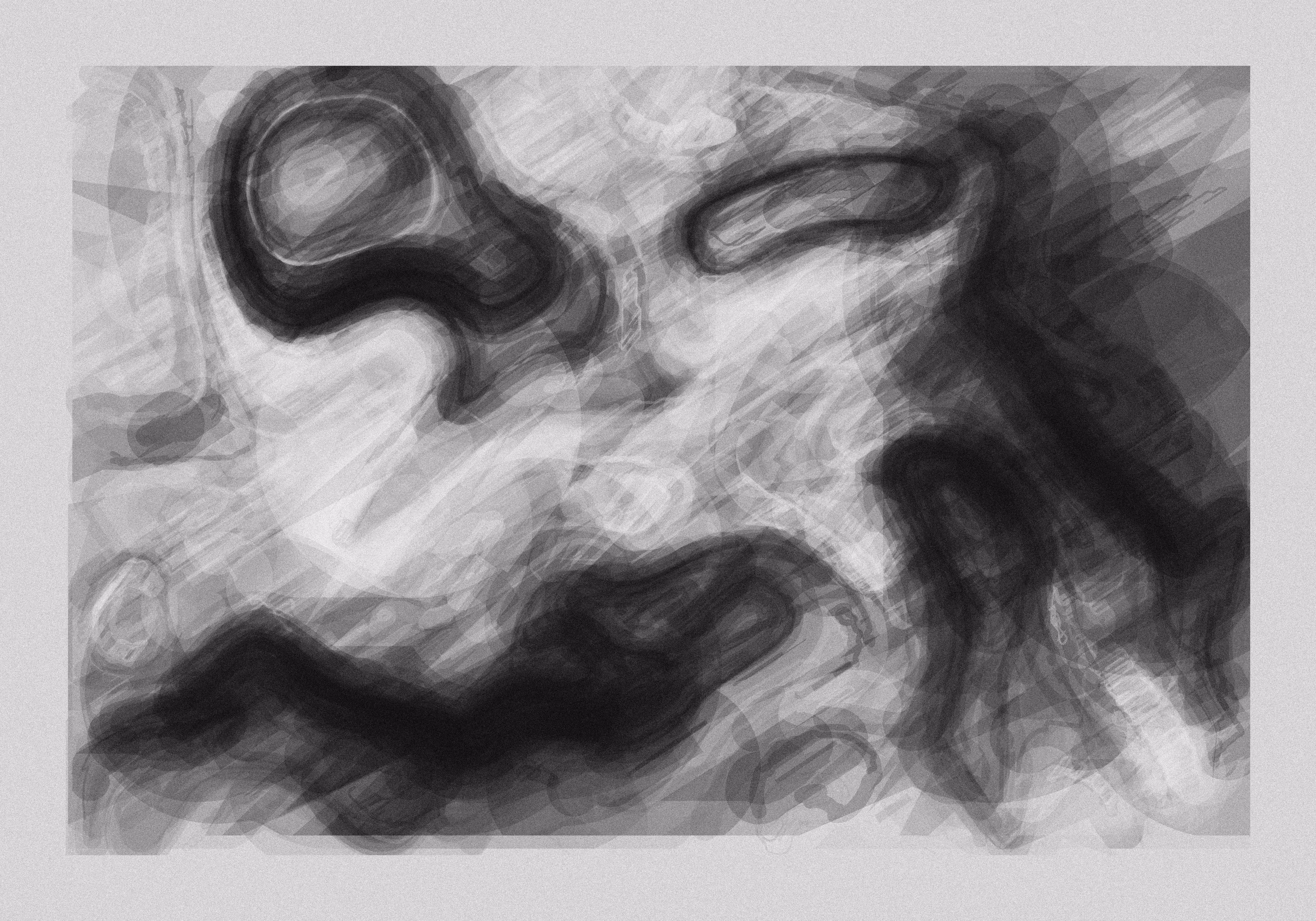 astigmatism_003