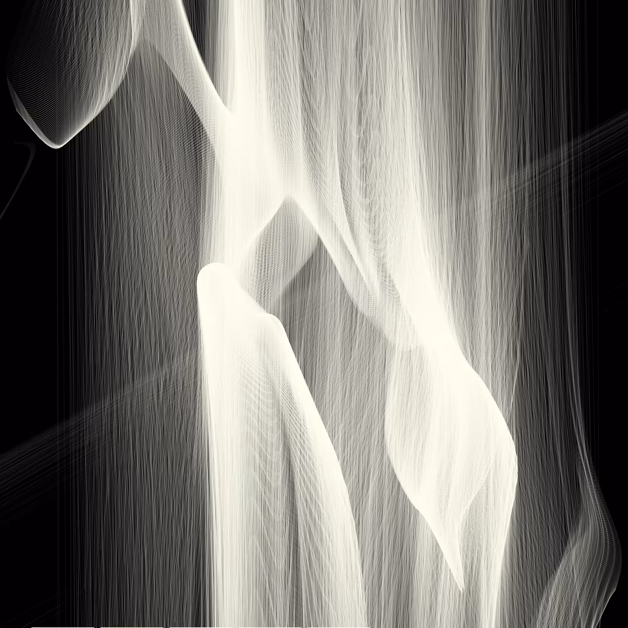 Rays of Light II #18
