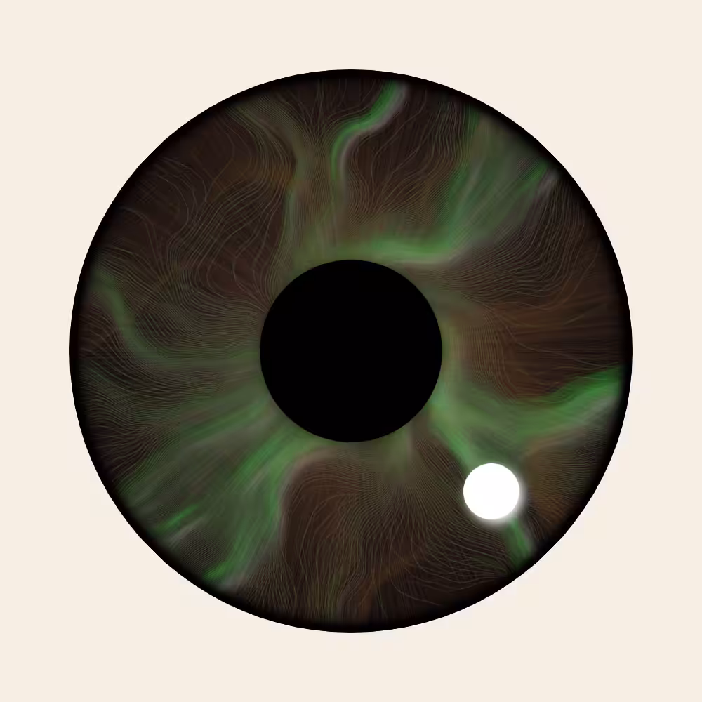 Iris Diffusion #18