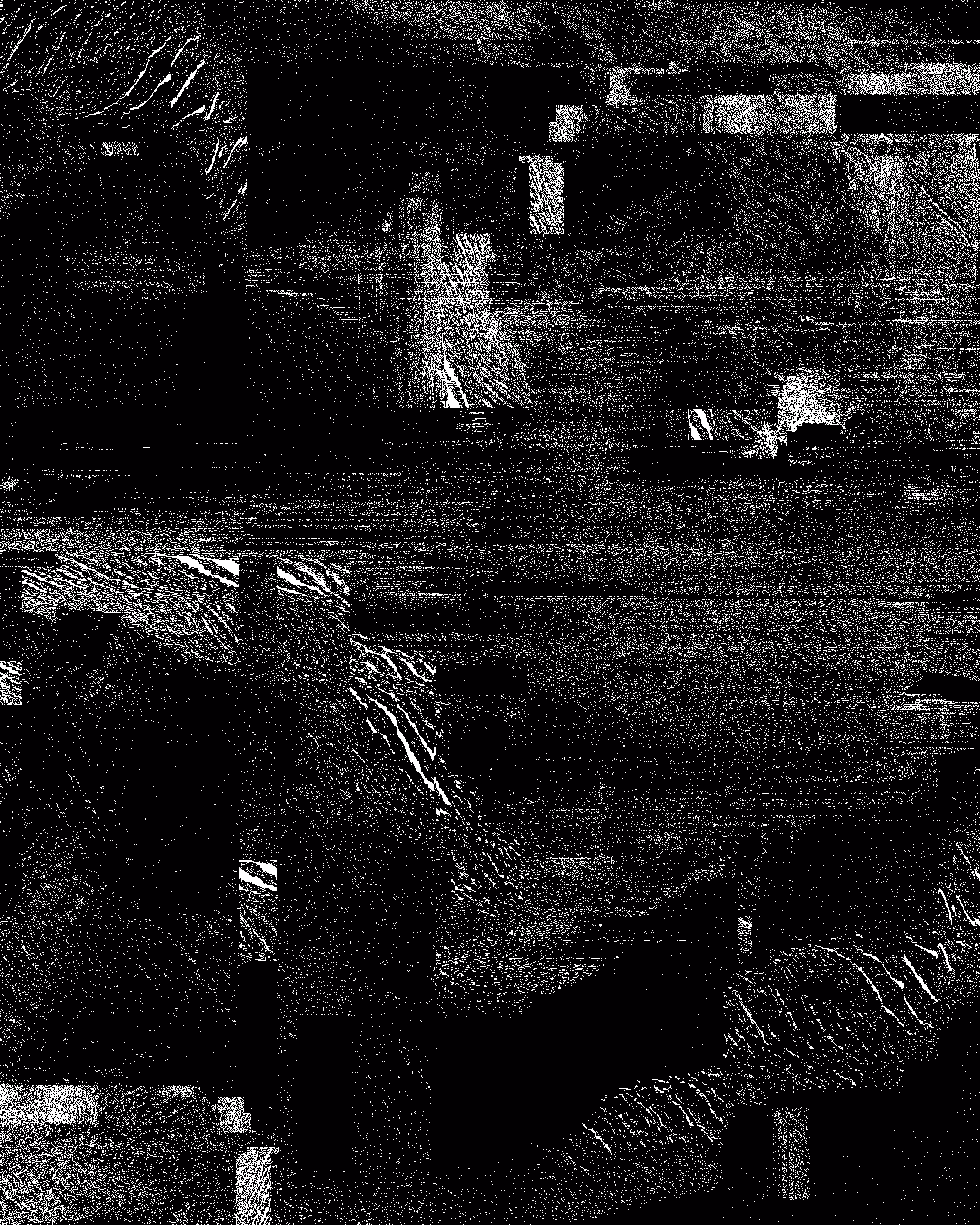 Coma