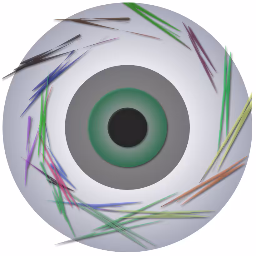 Iris 2 #28