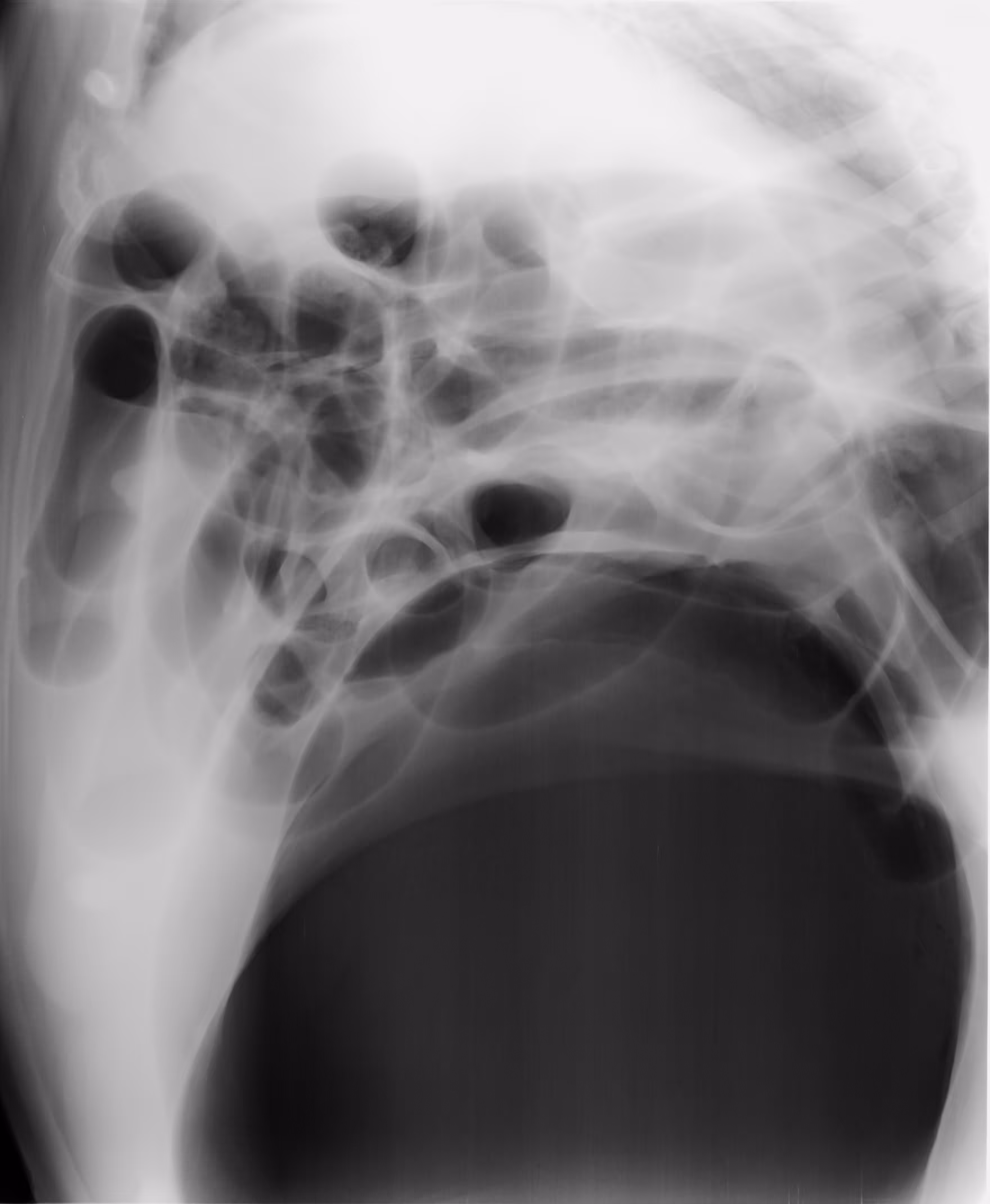 X-ray 05
