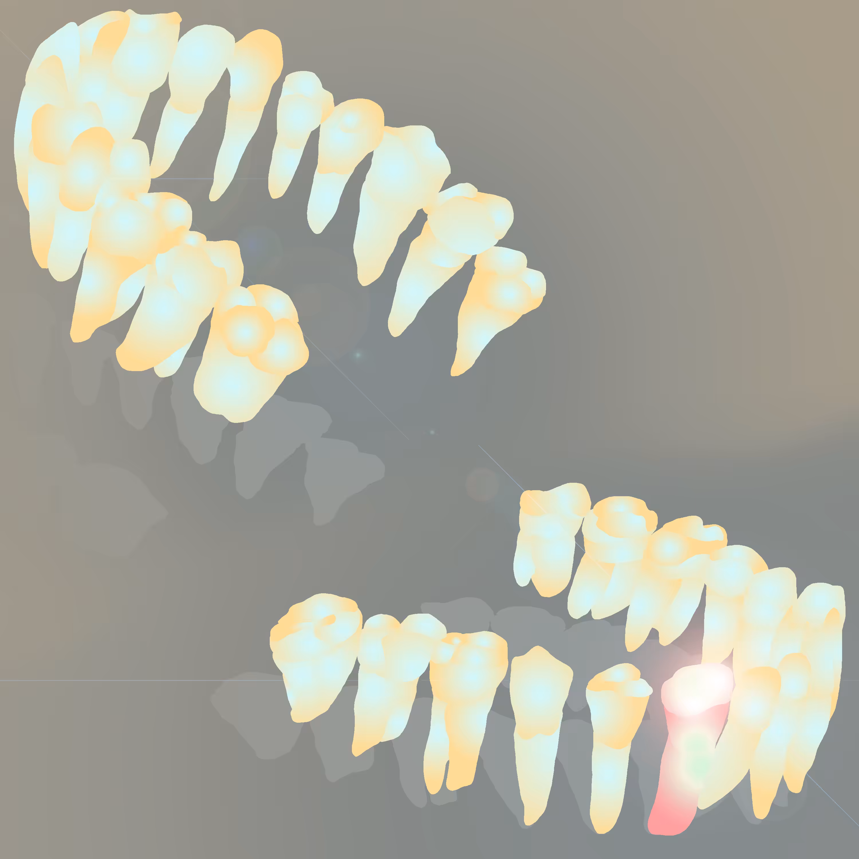 Pieza dental 32