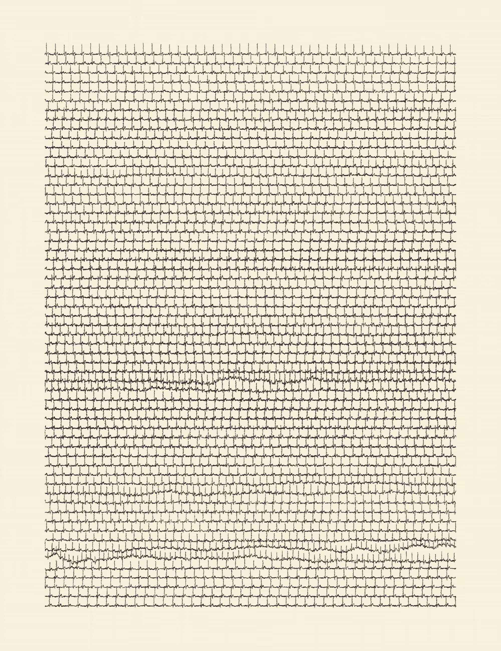 one hour #113