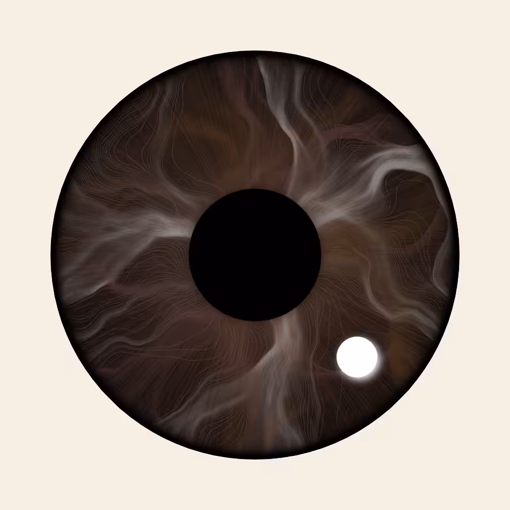 Iris Diffusion #11