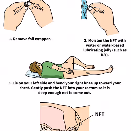 How to Collect an NFT
