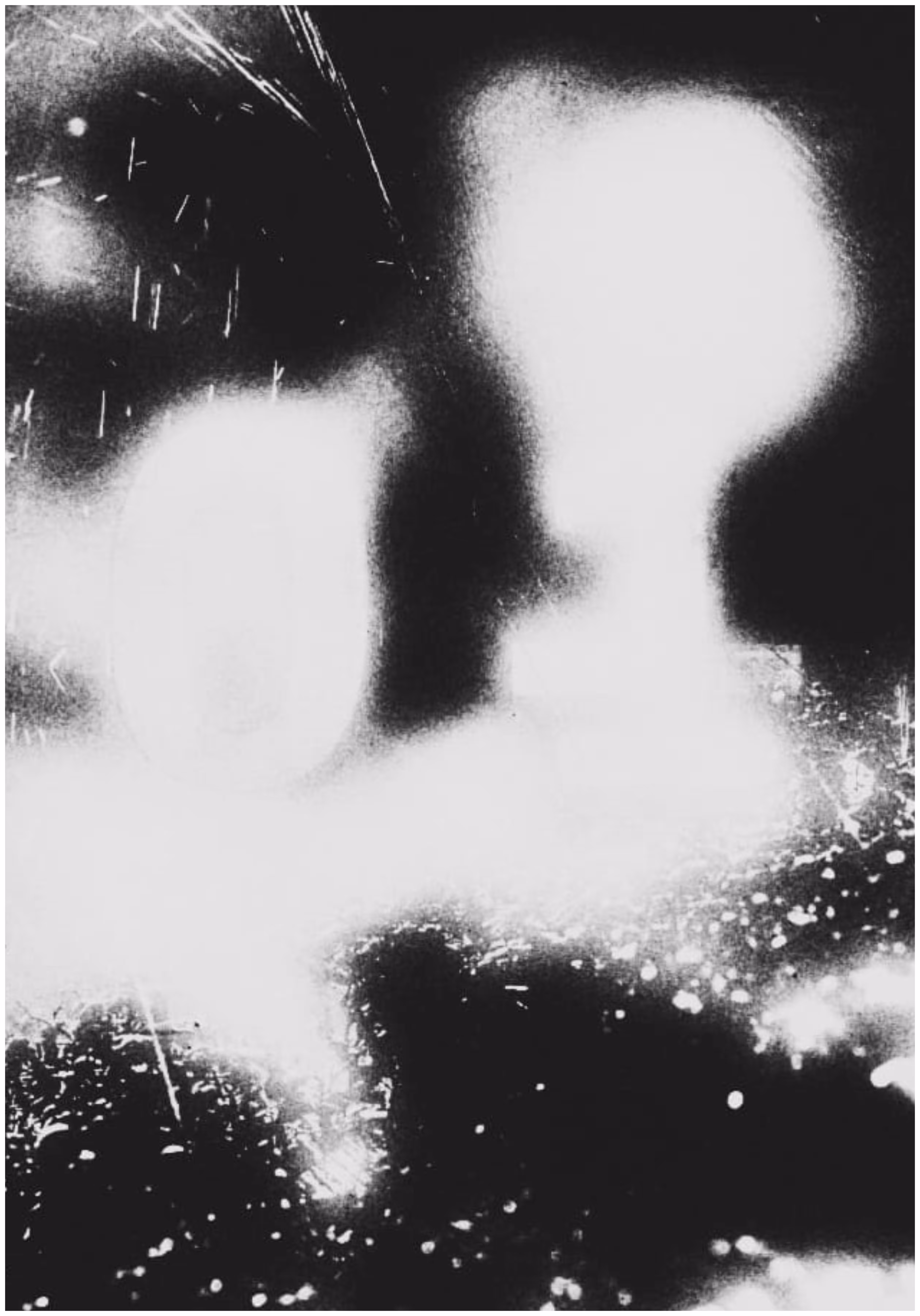 Shadow