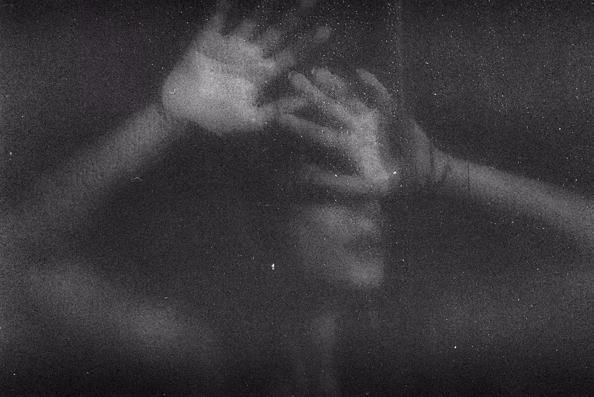 Amnesia