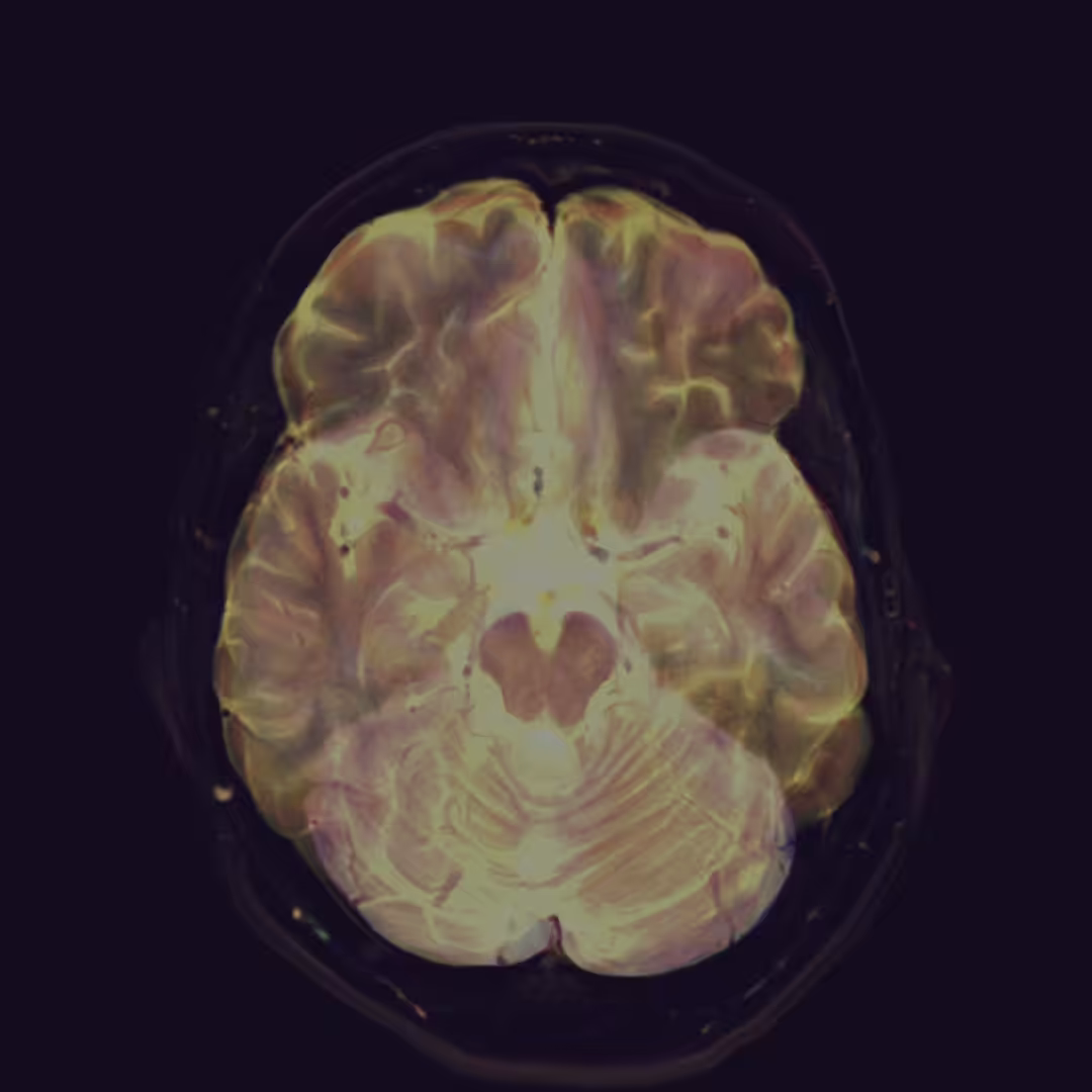 Diagnostics #3