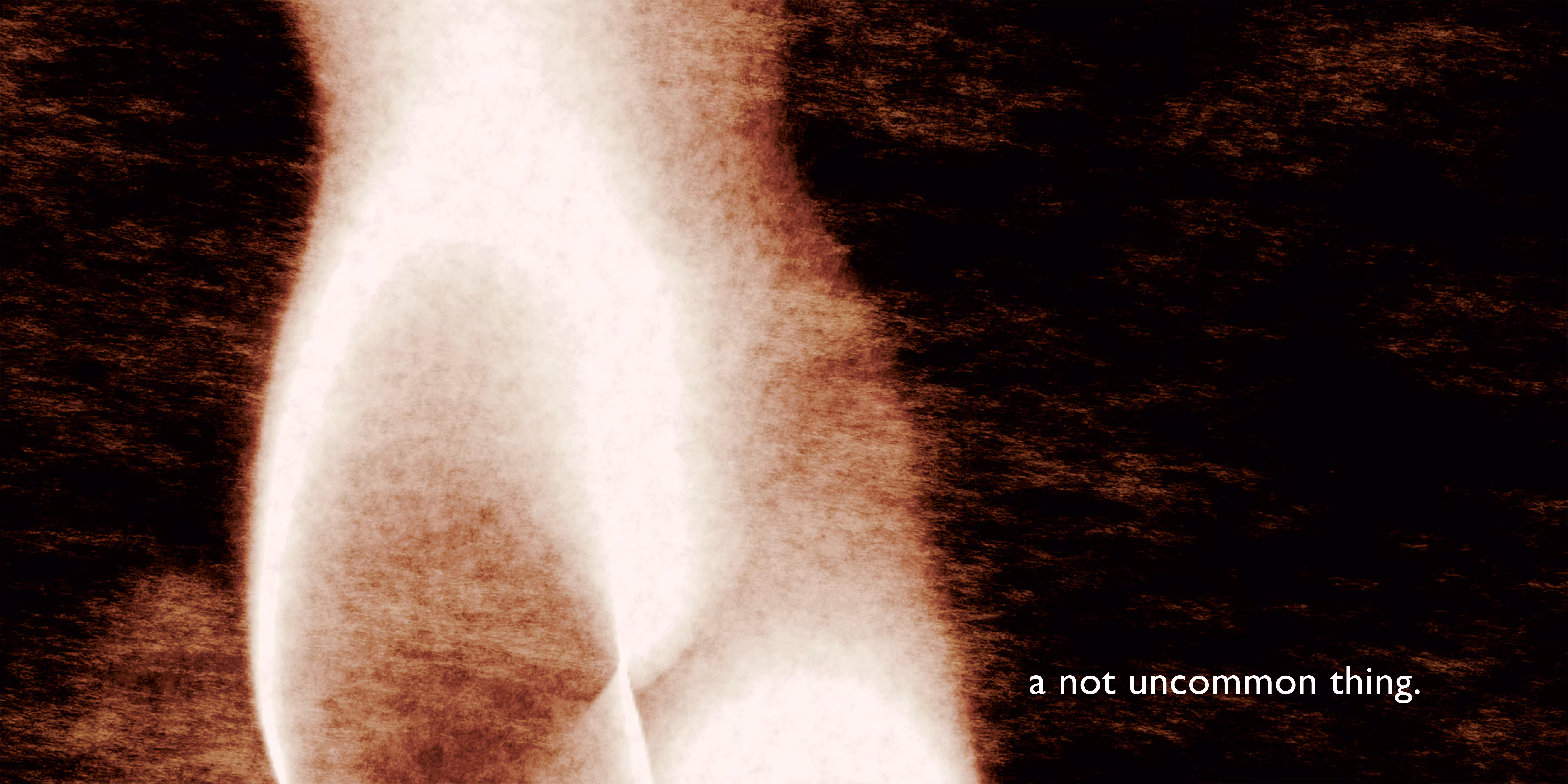 A not uncommon thing