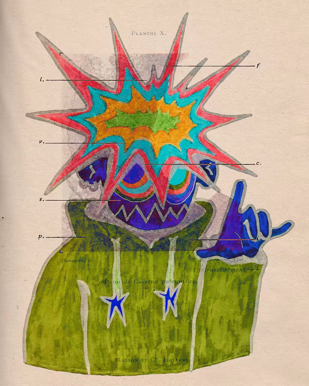 BRAINBOMB