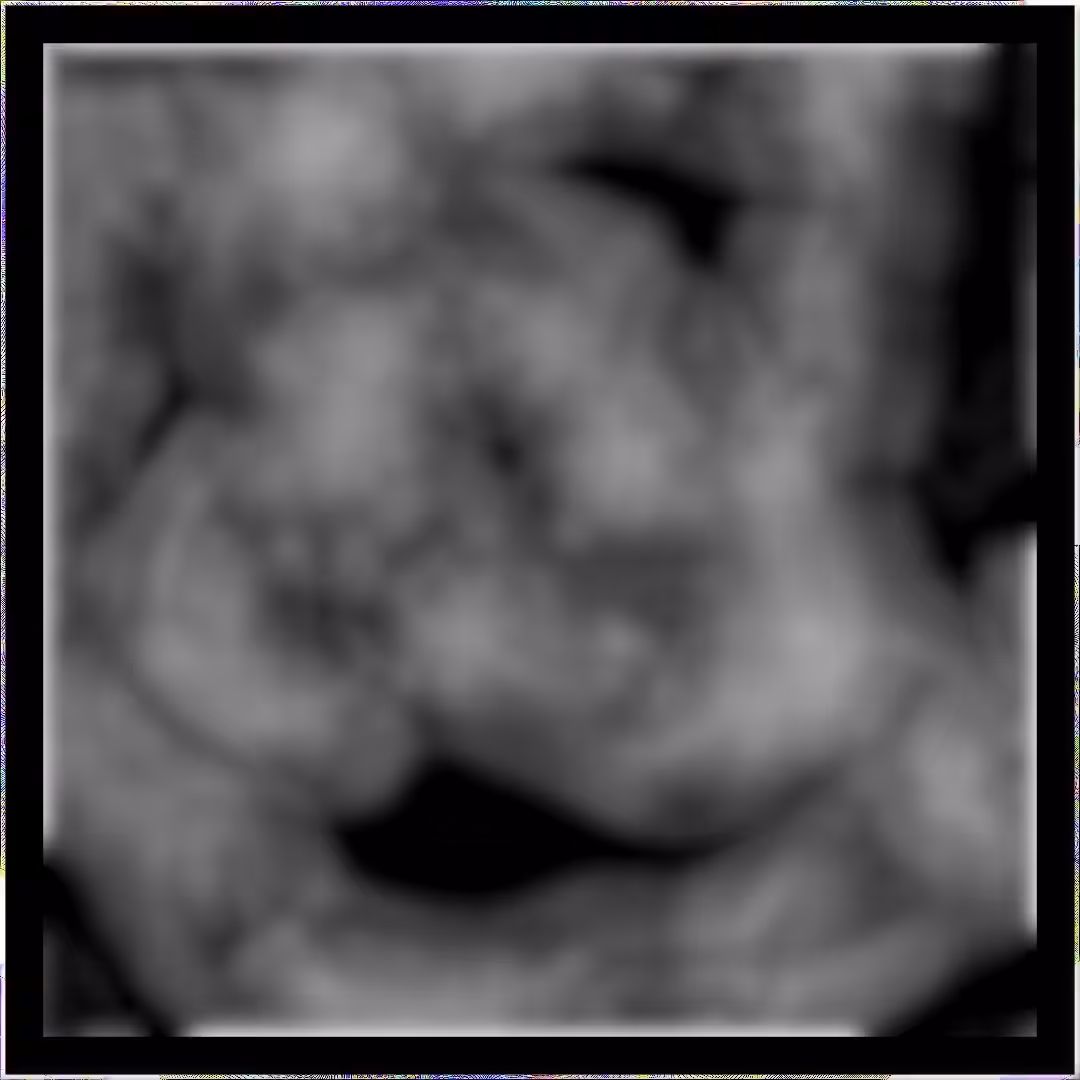 STRAIN PROPAGATION