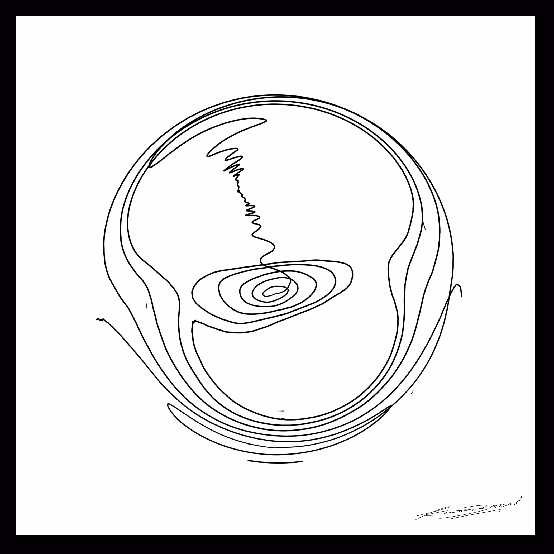 ARISING CAUSELESSLY