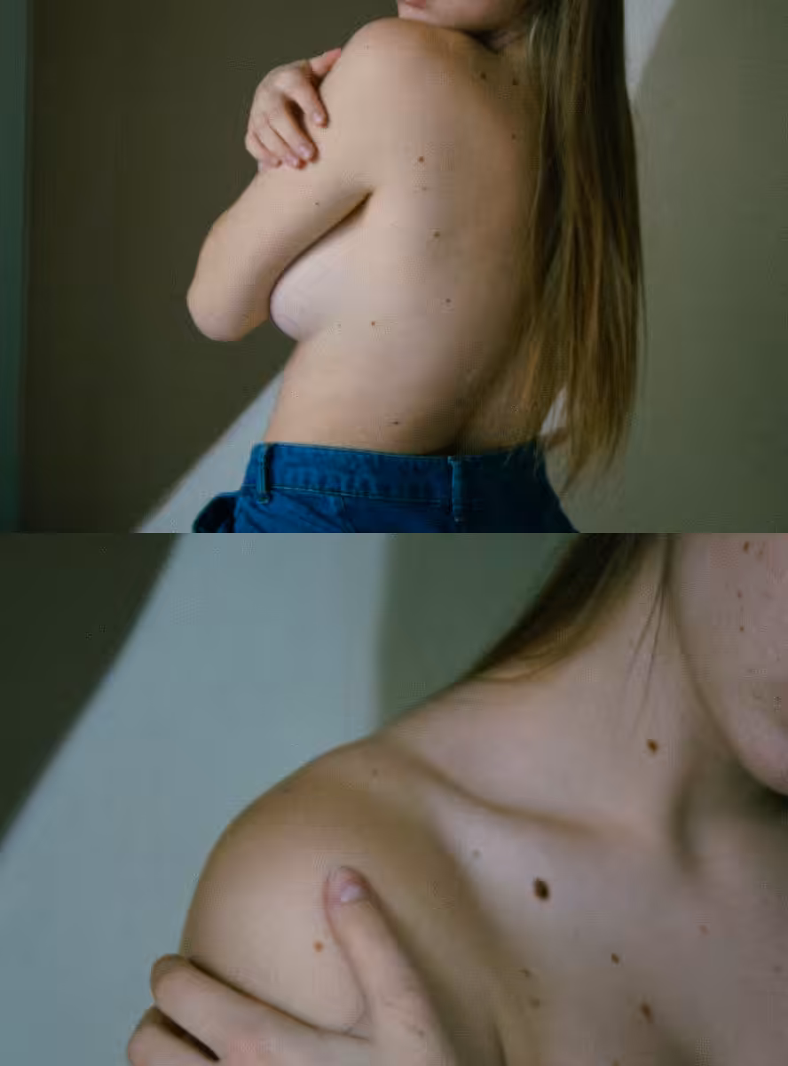 i will count all her moles