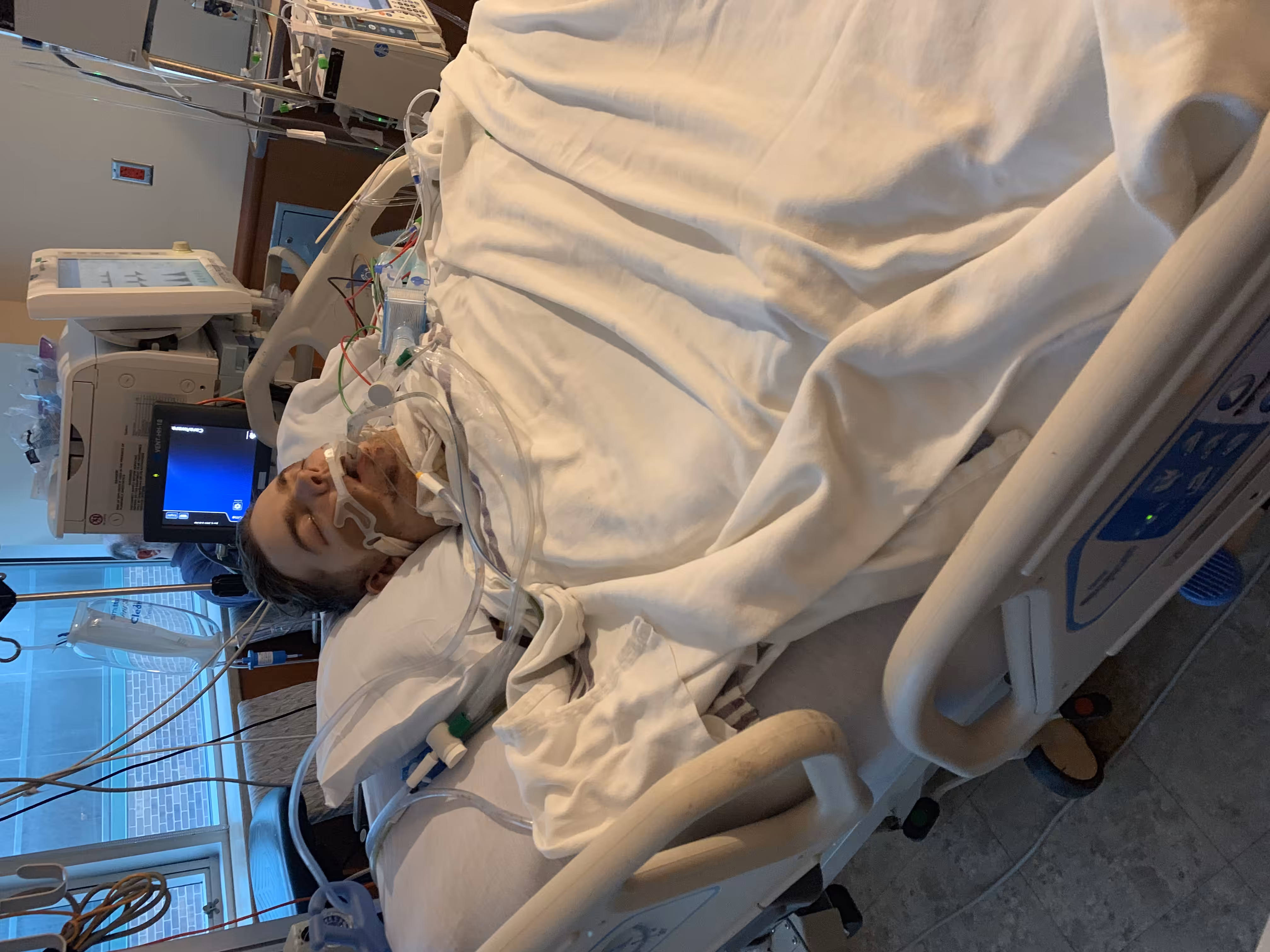 SAVE BRAD: Comatose 