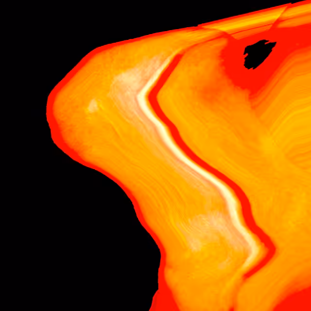 “LZFBtOiC” | [03_BGANR]