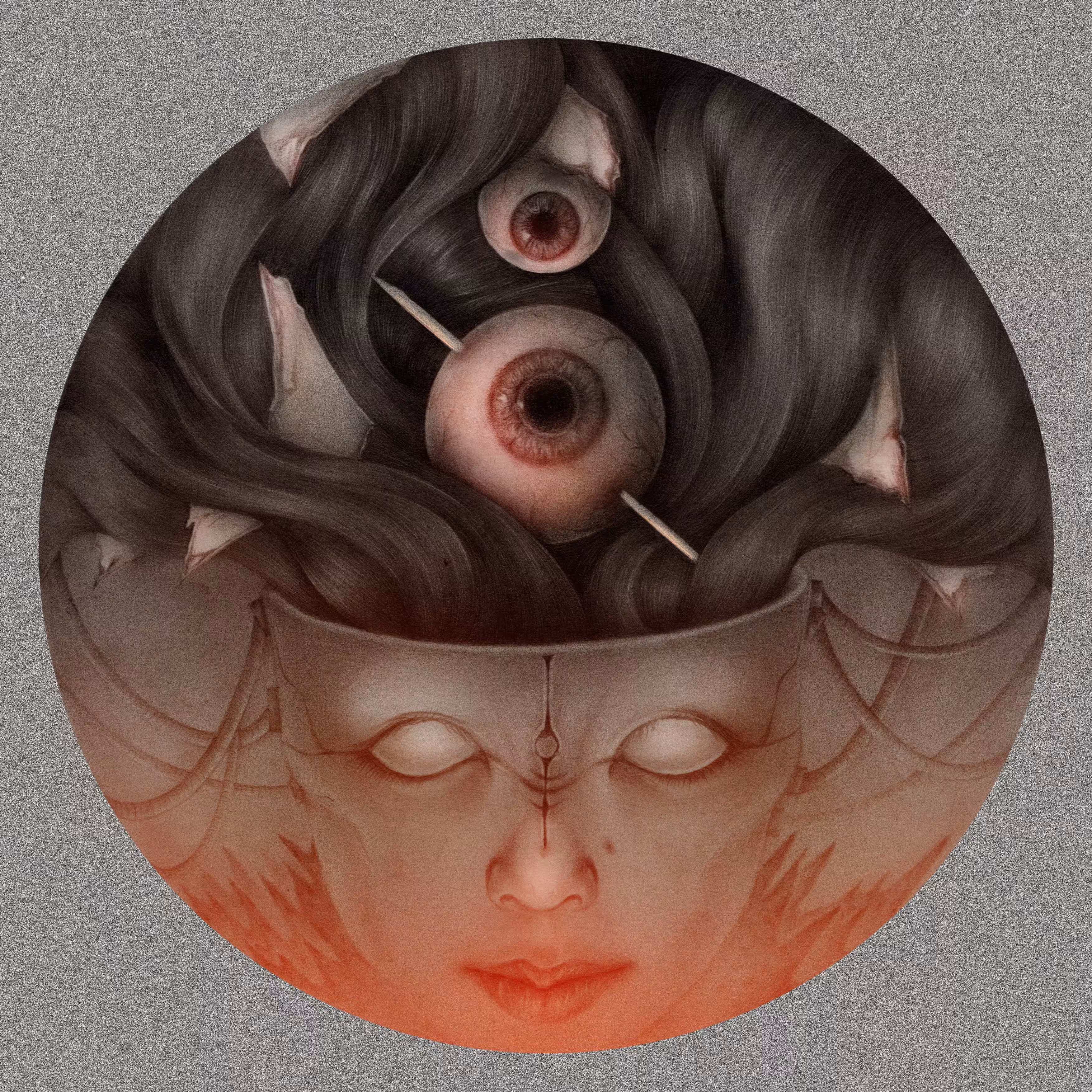 Migraine