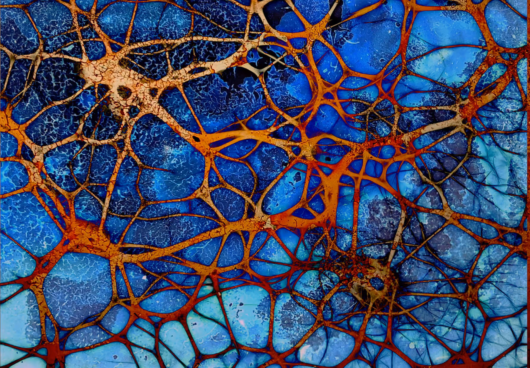 Axons and dendrites