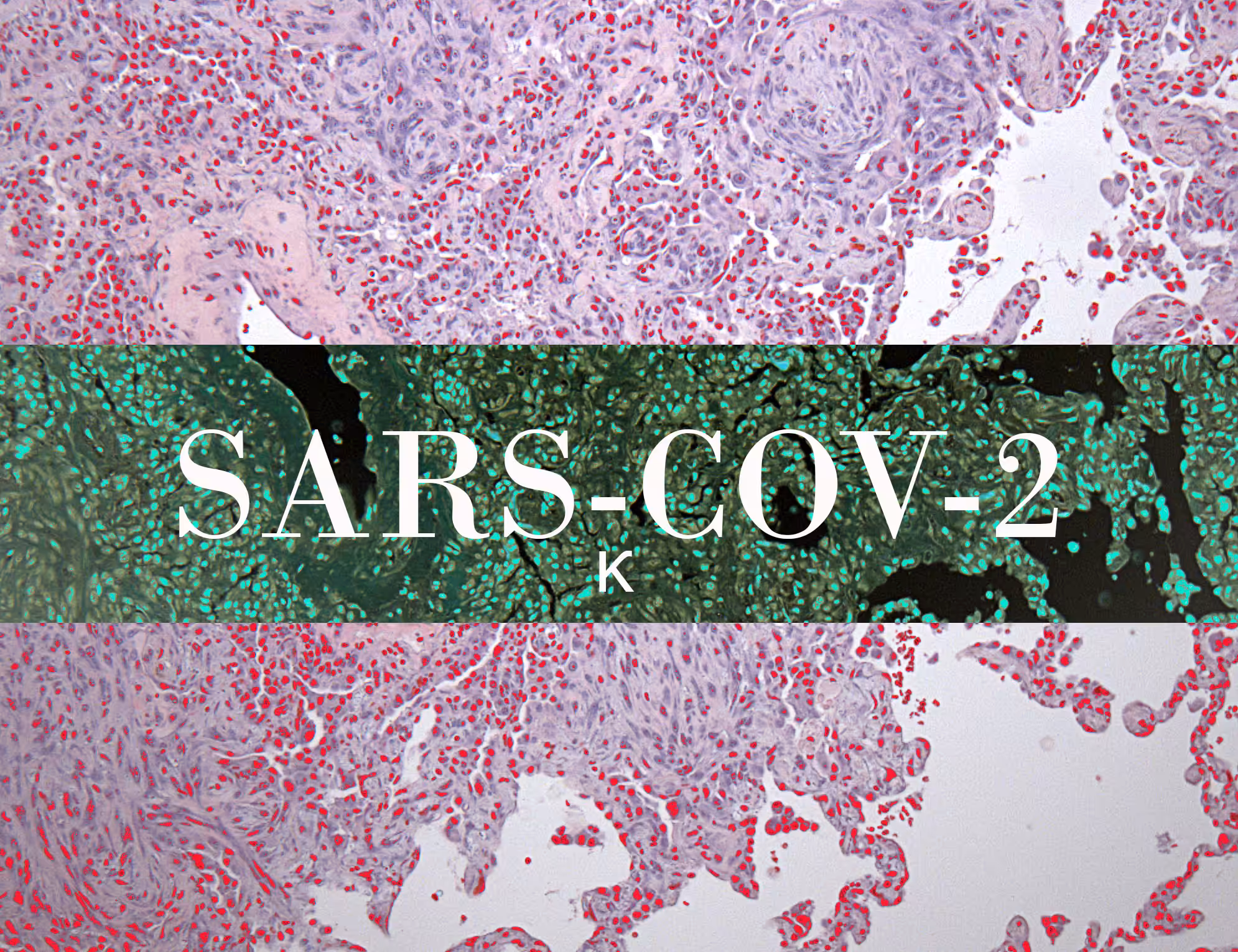 SARS-COV-2κ