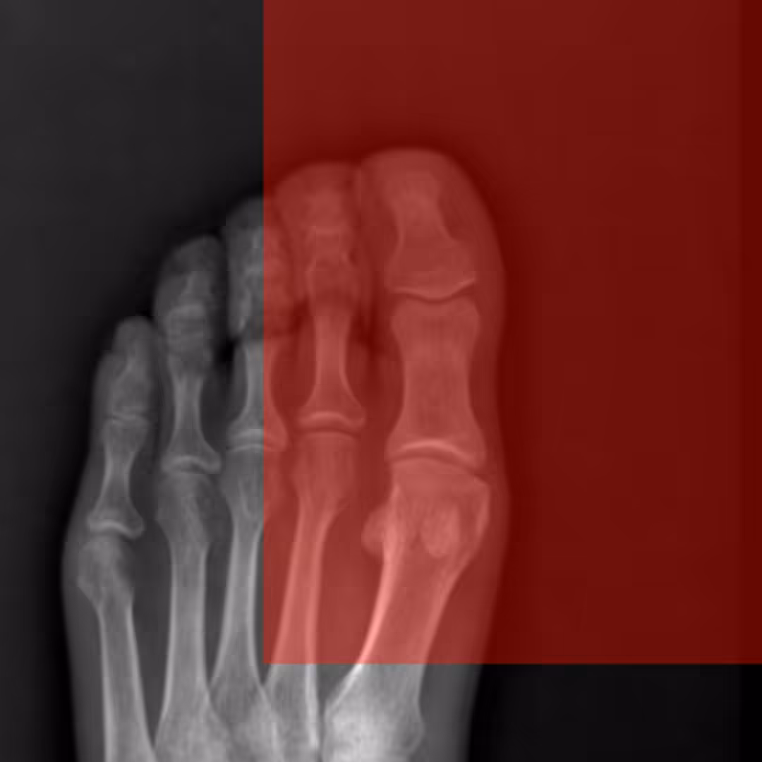 X-Ray_01