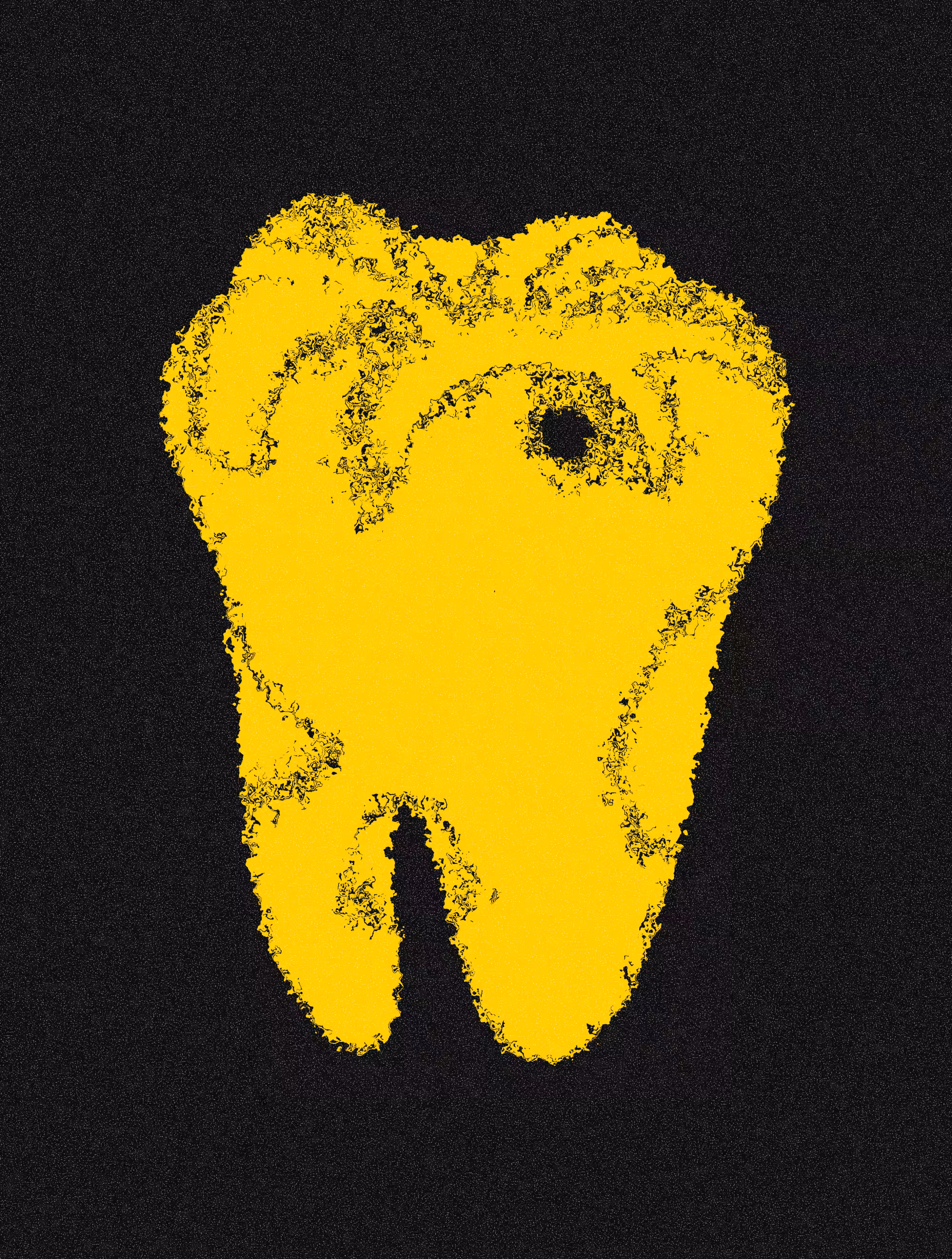 Gold Tooth